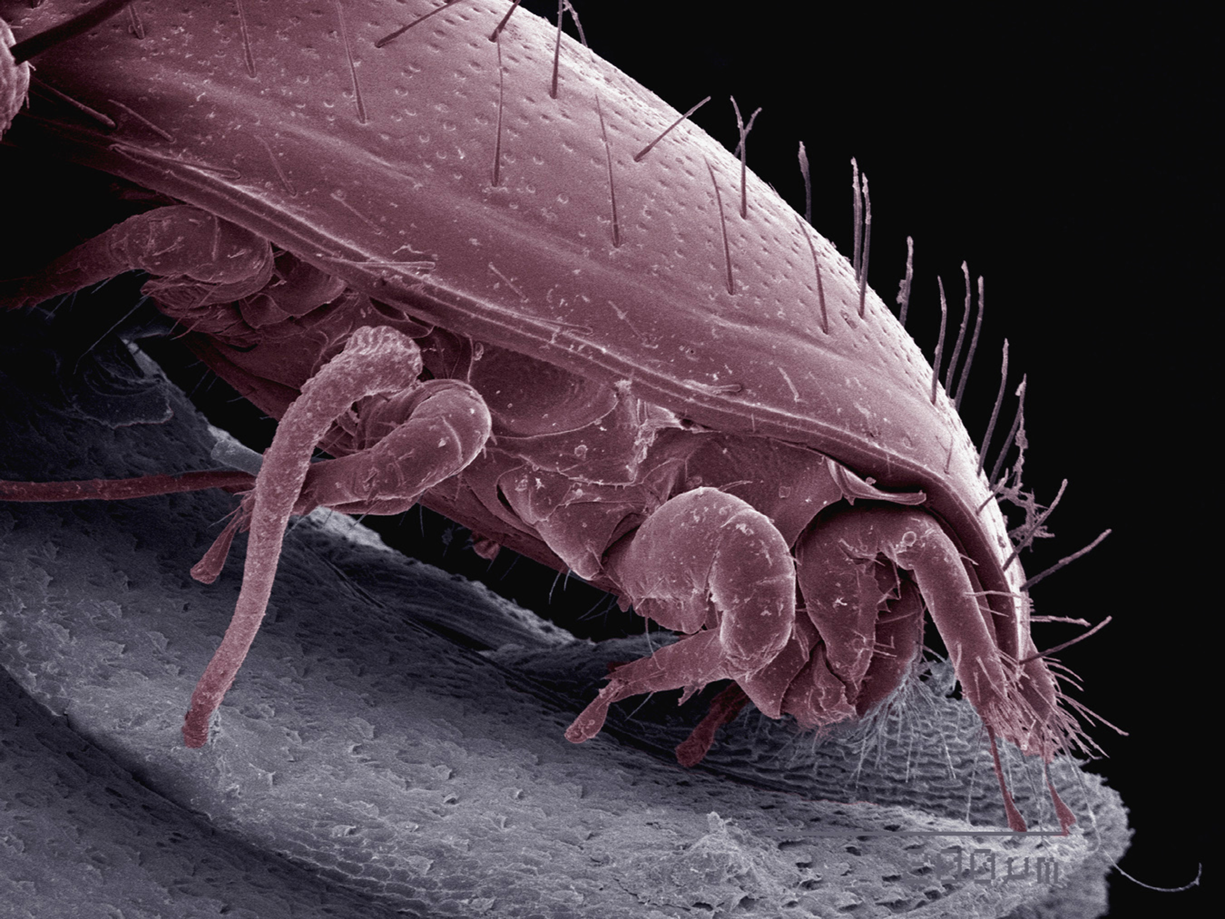 أسباب الجرب