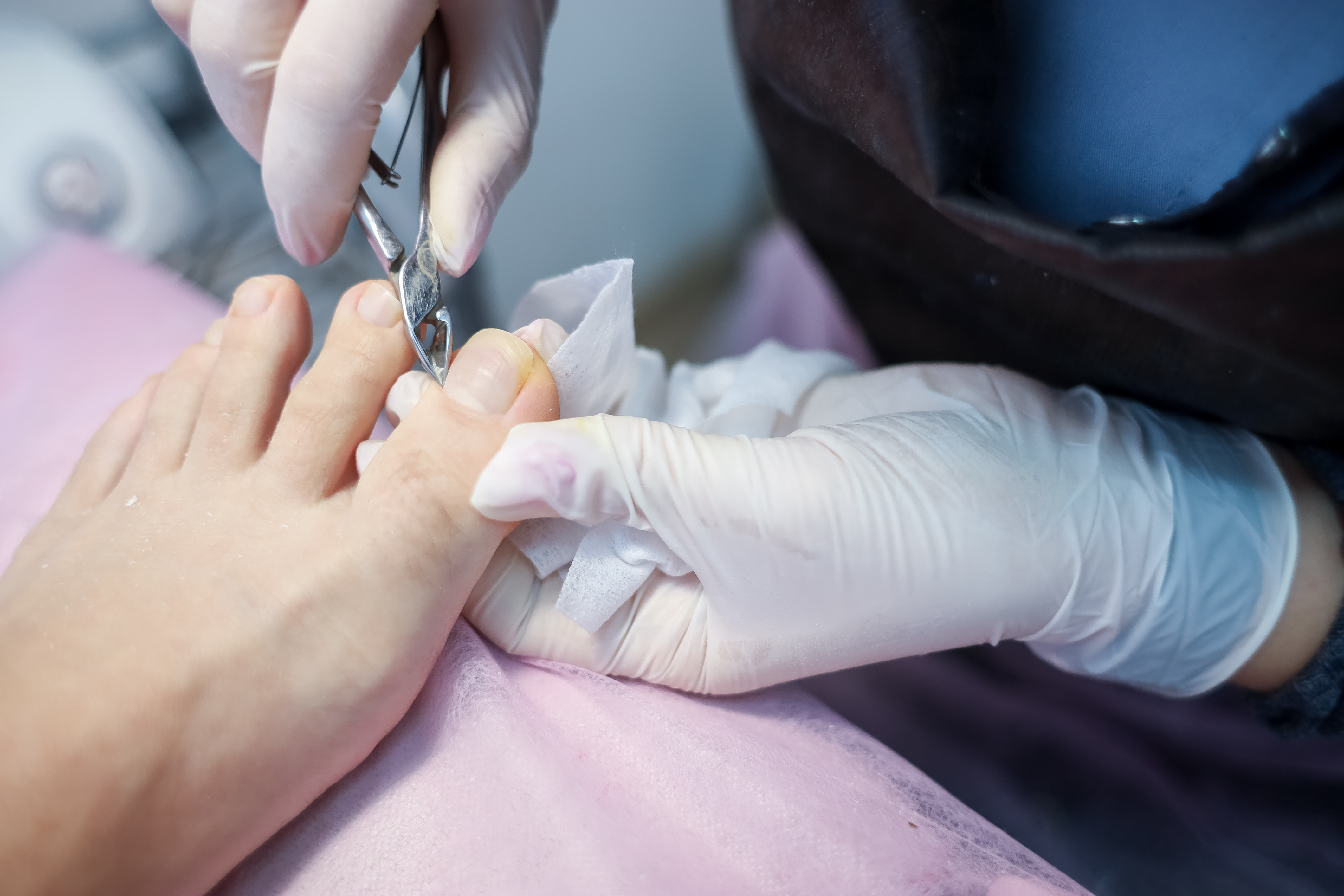 الوقاية من القدم السكرية