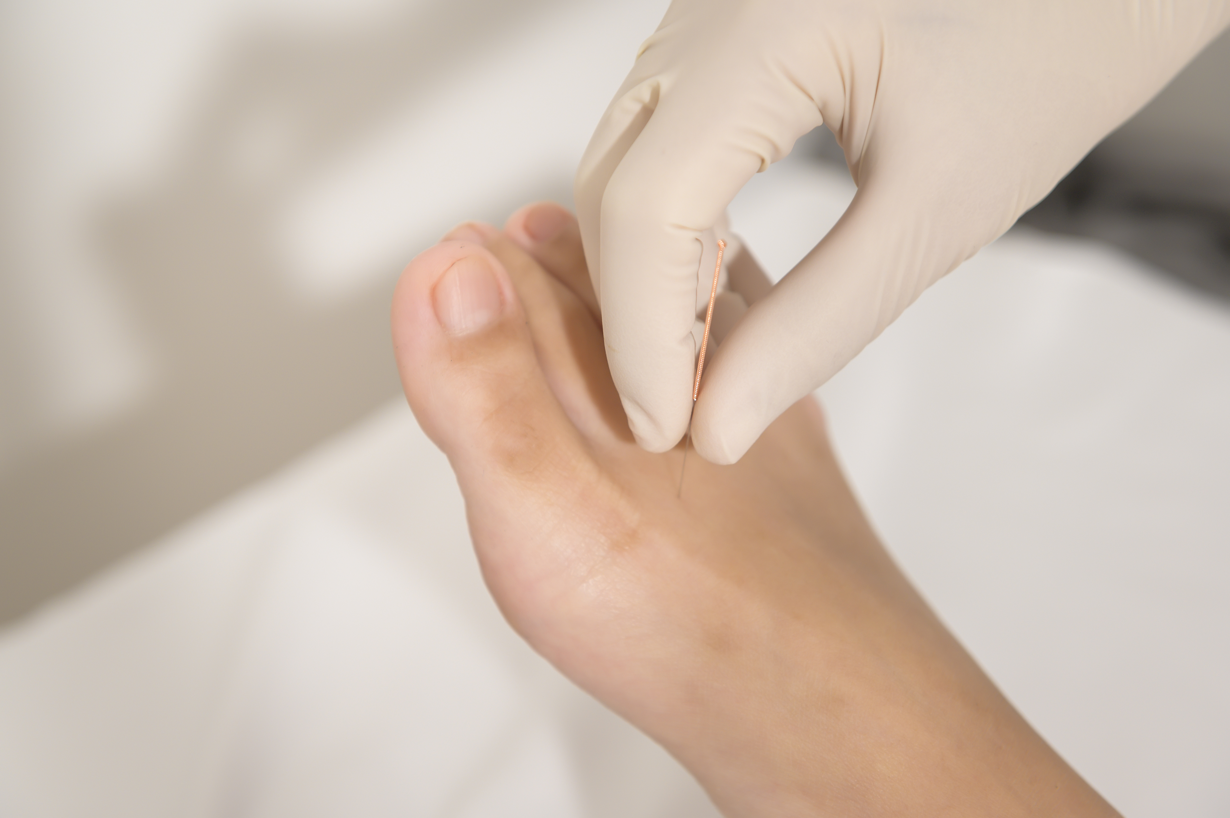 ما هي القدم السكرية؟