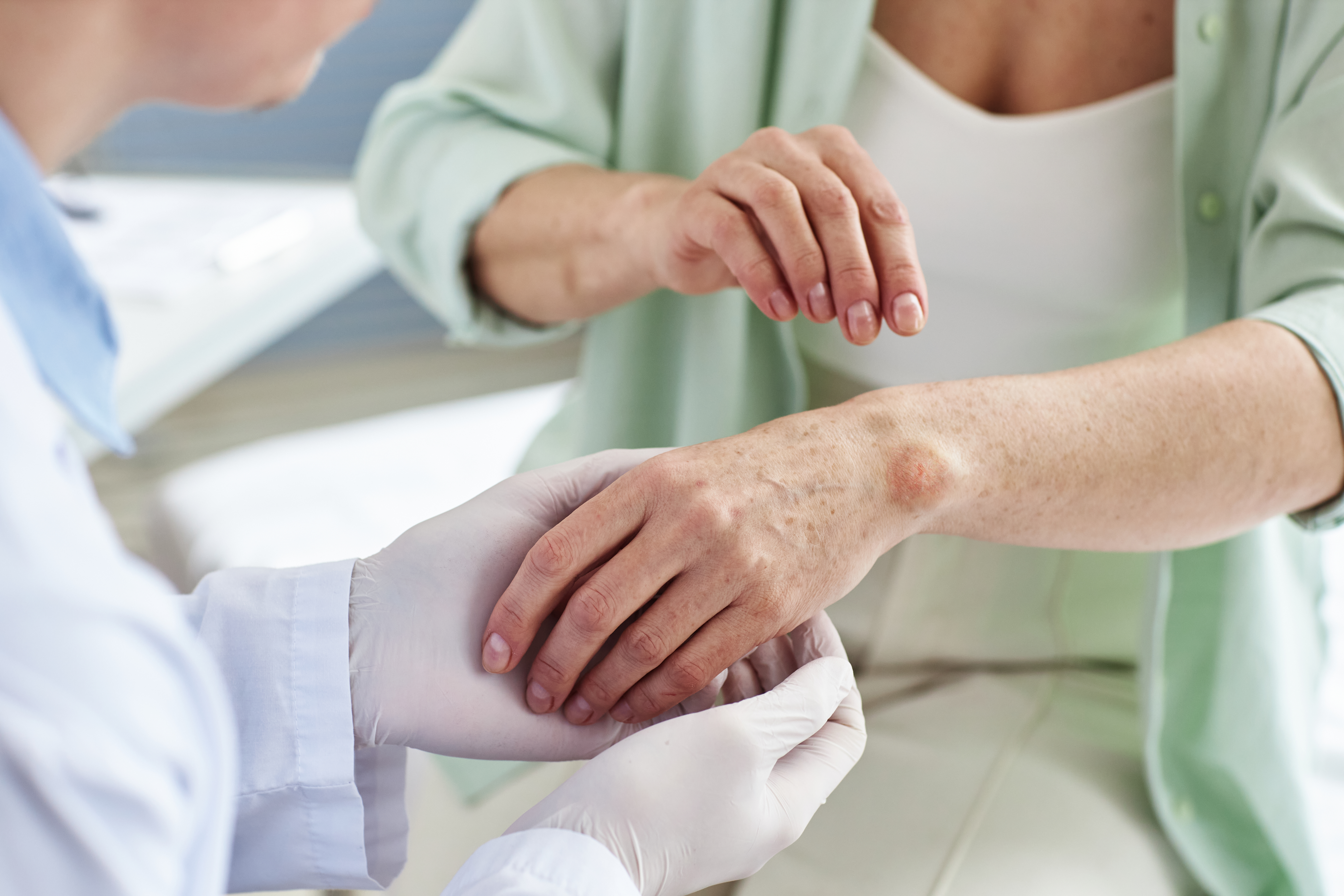 ما هو مرض الجذام؟