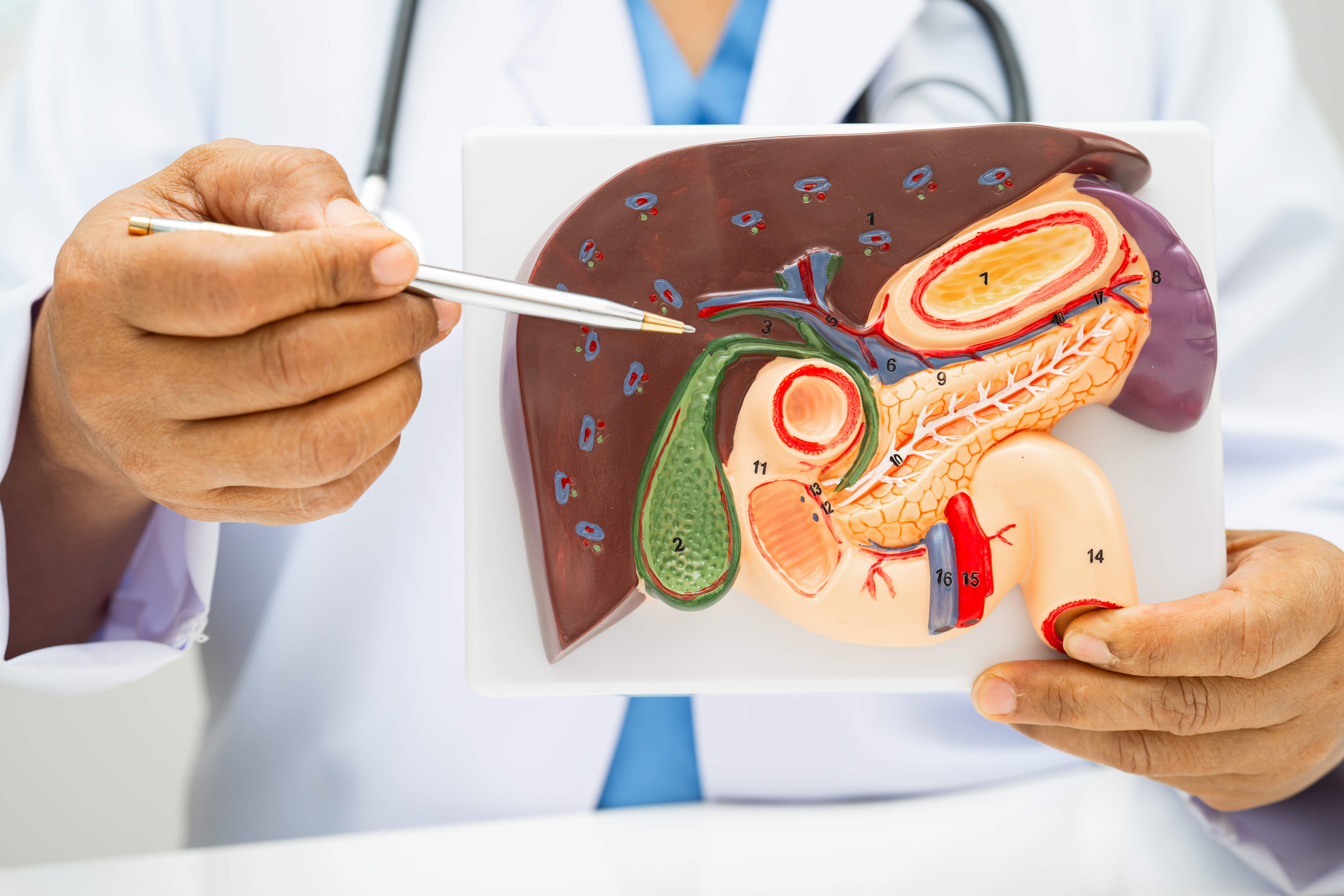 بالصور تليف الكبد: الأعراض، الأسباب، والعلاج