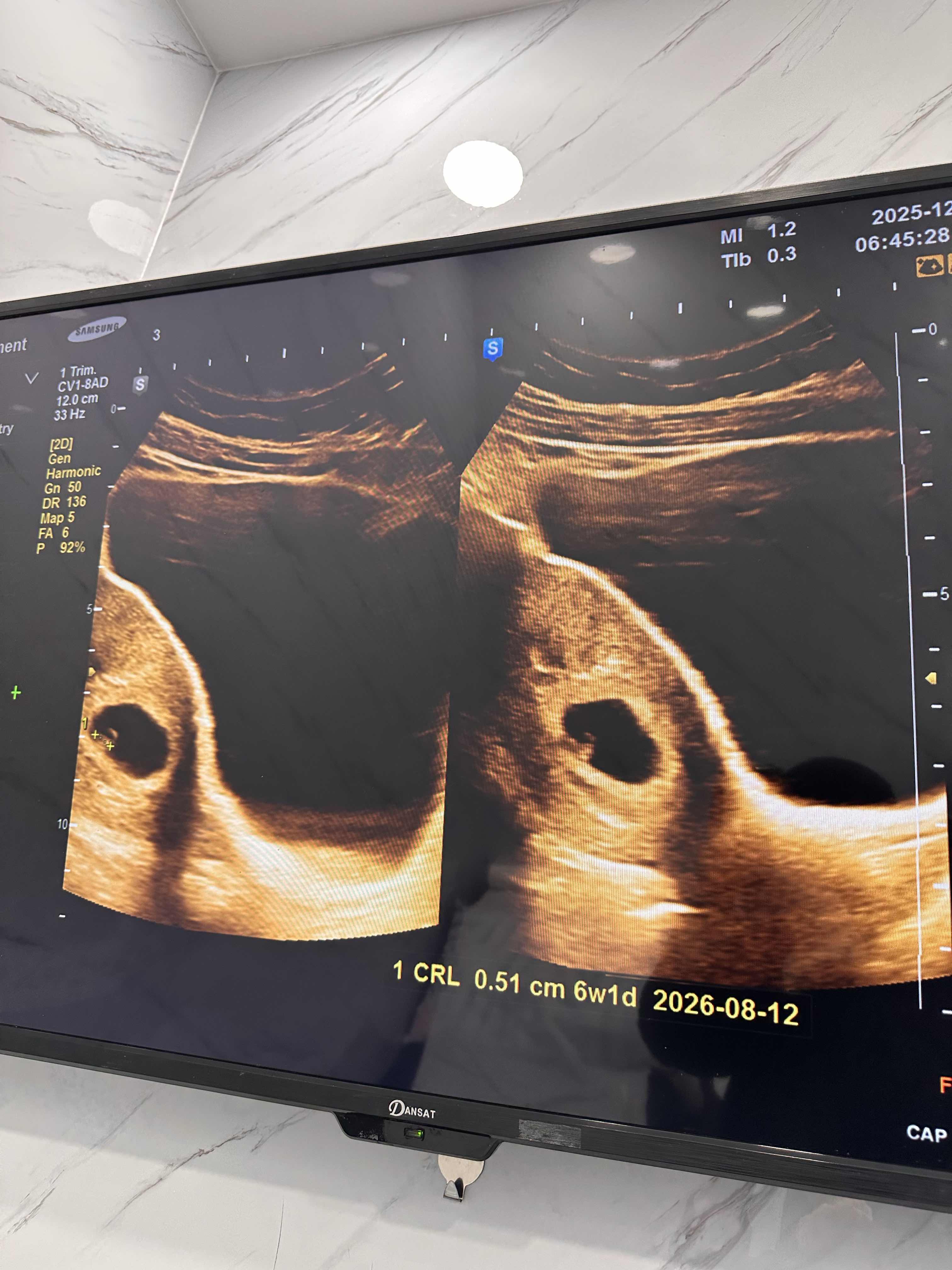 DD3ED76B-25BE-4A0F-8CD9-ED7921664EB7