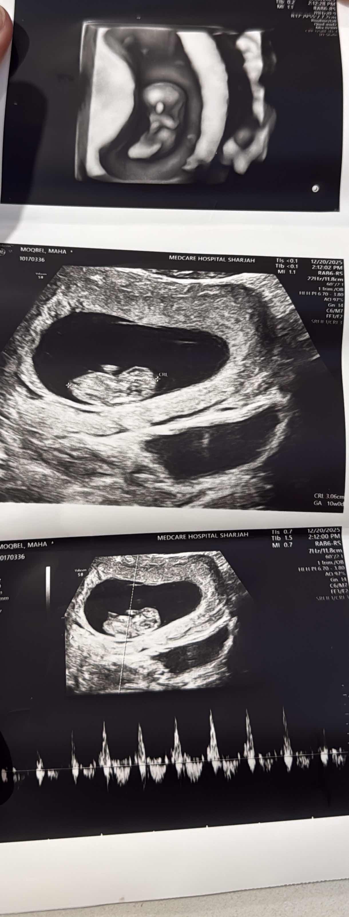 A39A81BD-8251-4867-B4AE-A1EEBB48C0DE