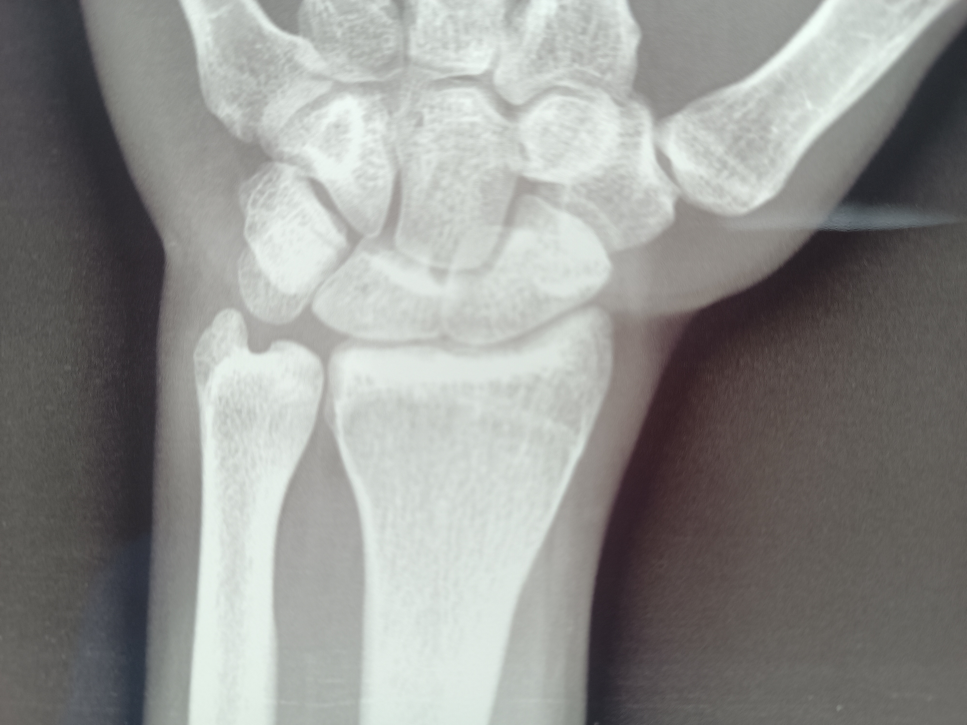 17668308964955558086527855538693