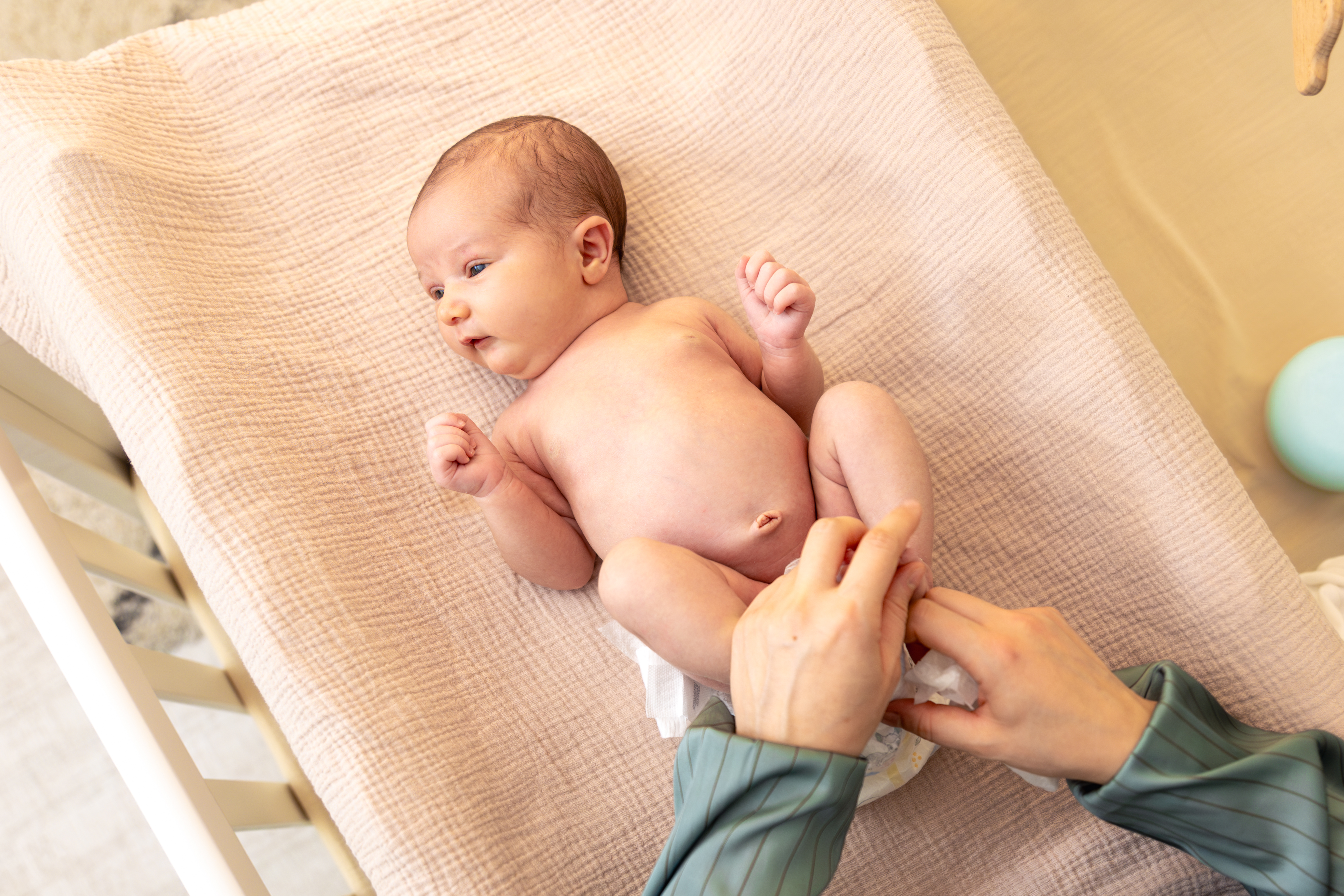 أعراض الفتق السري بالصور: العلامات ومتى يكون خطيرًا؟