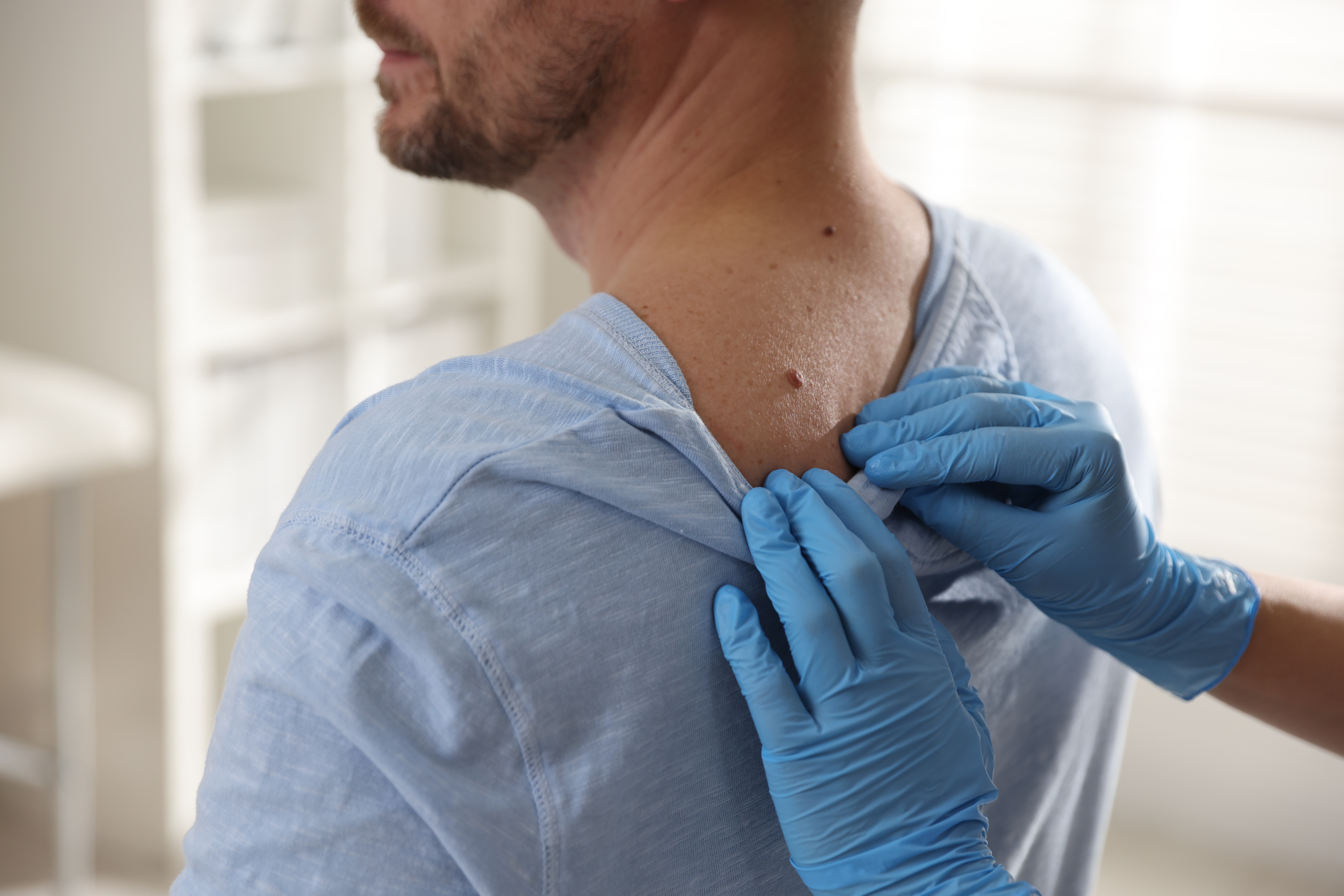 أين تظهر الزوائد الجلدية؟