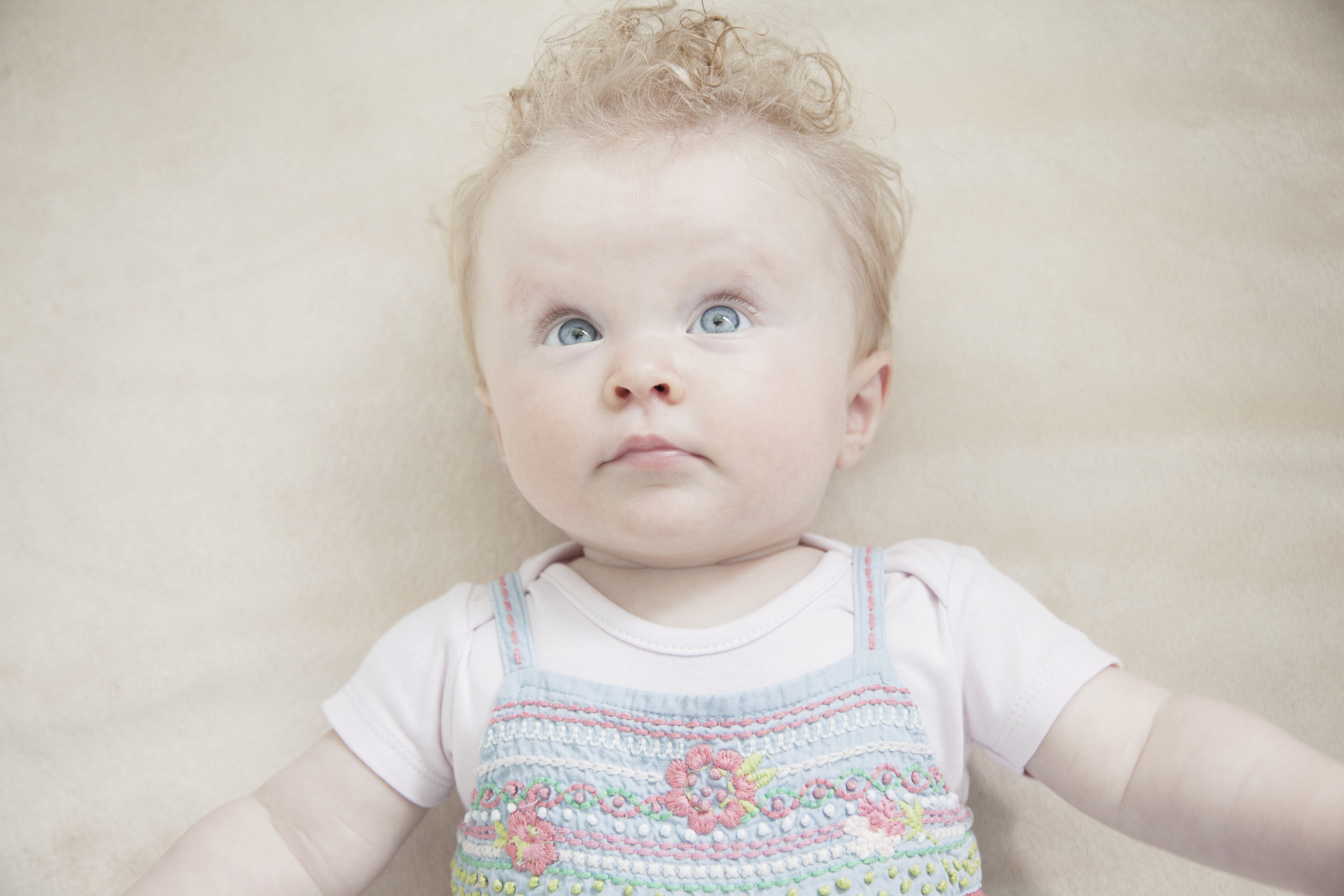 3. البرص حالة خِلقية تظهر منذ الولادة