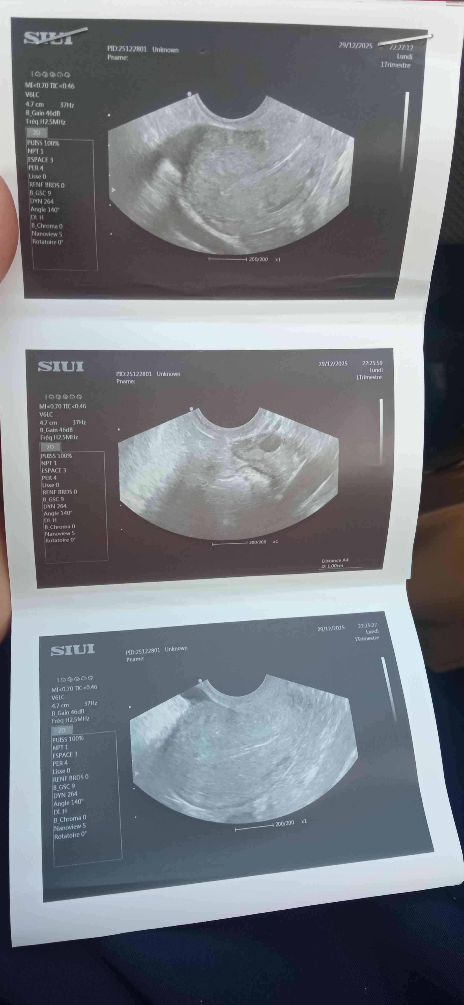 c5d28e0a-044e-47cf-ae6a-dff8cc24fb78