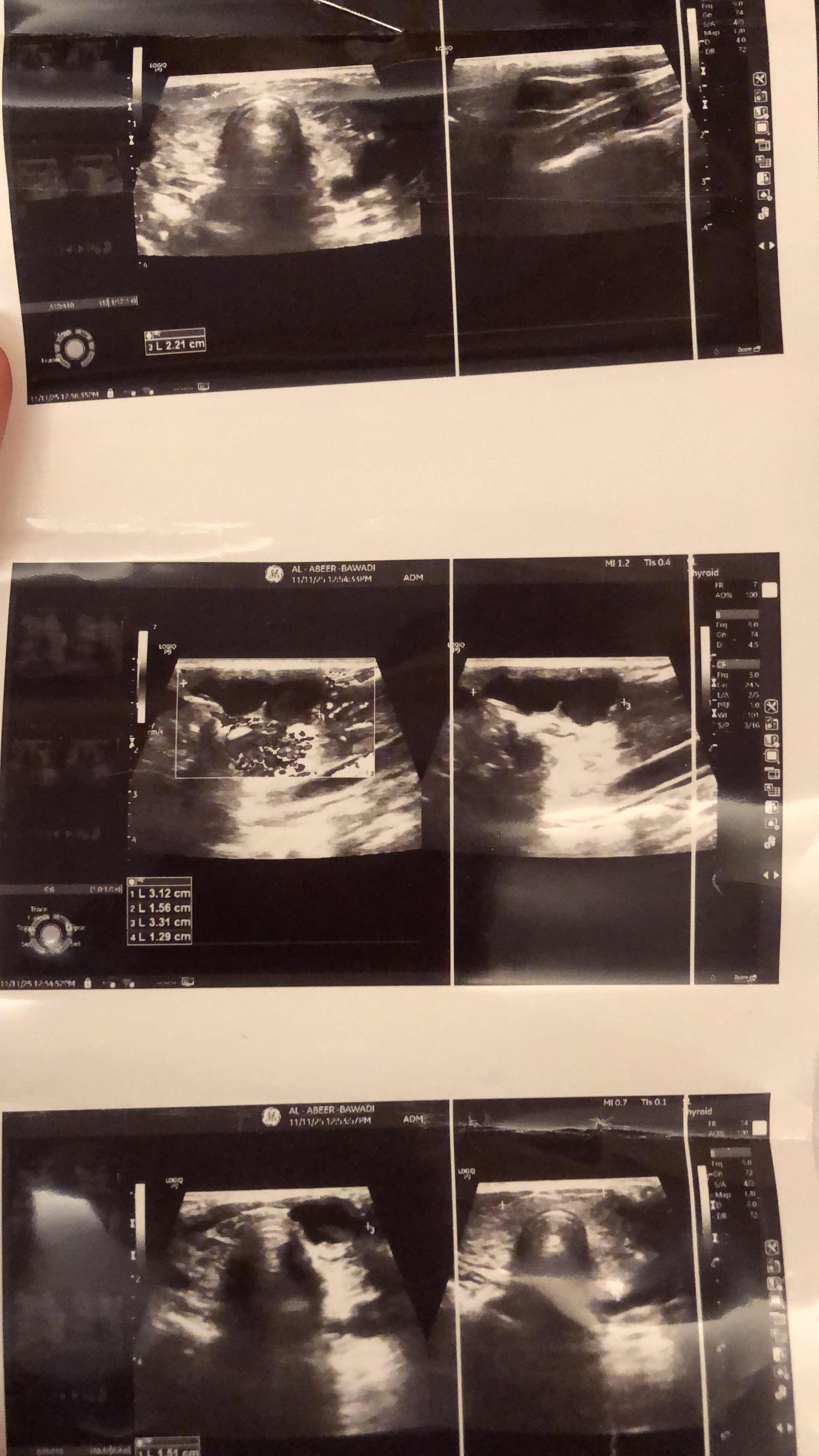 DD9C33F4-8537-41F6-BB37-0A65BA91631E