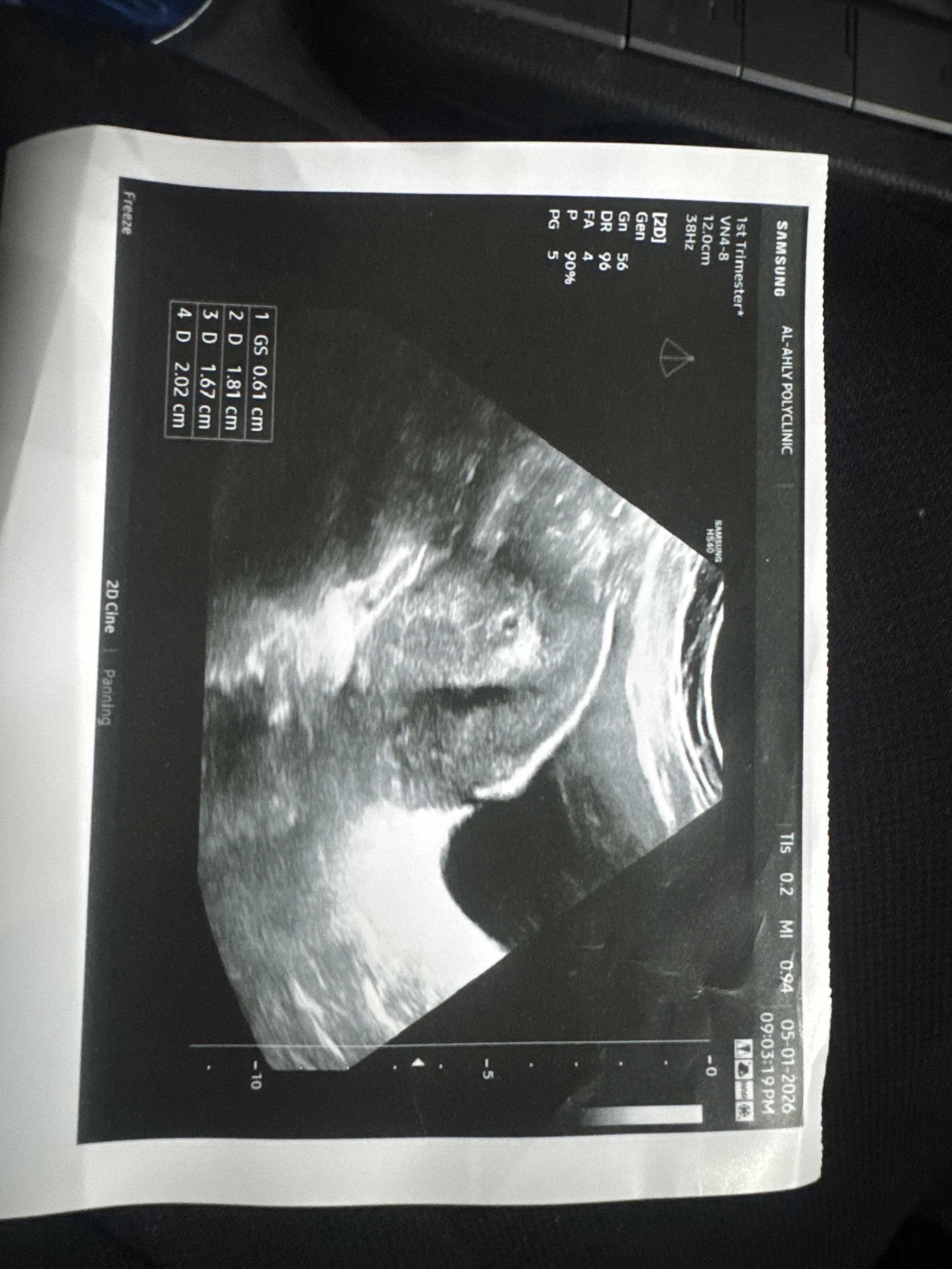 565891A8-BDF6-475E-B63D-6D2D746A2A4D