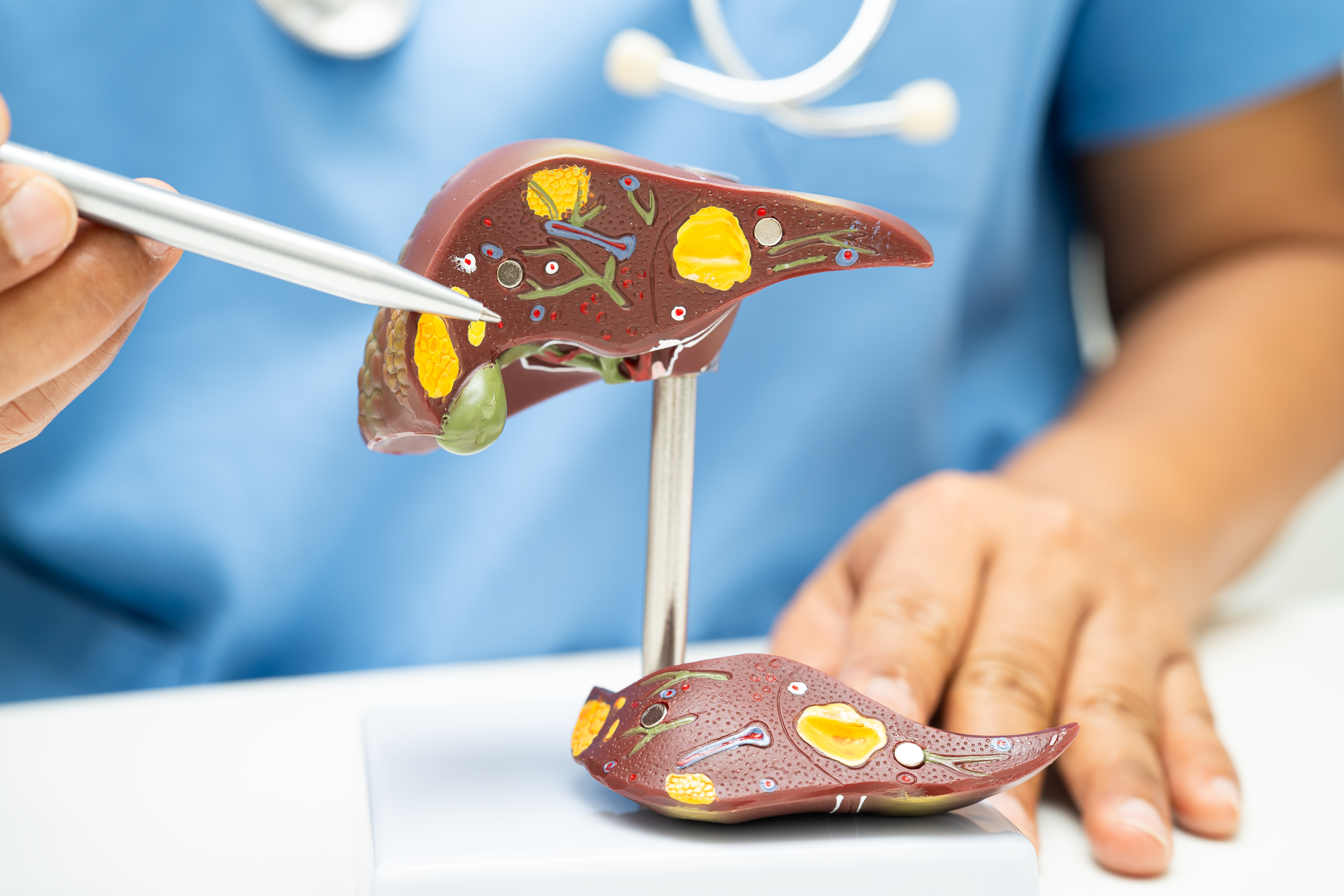 ألم المرارة بالصور: أماكنه الشائعة والأعراض المرافقة