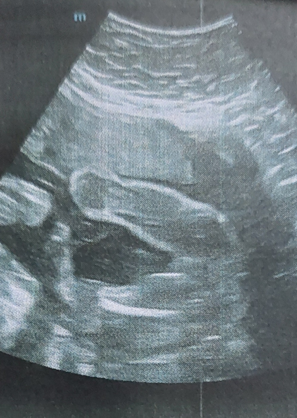 ٢٠٢٦٠١٠٣_٢١٢٠٤٥