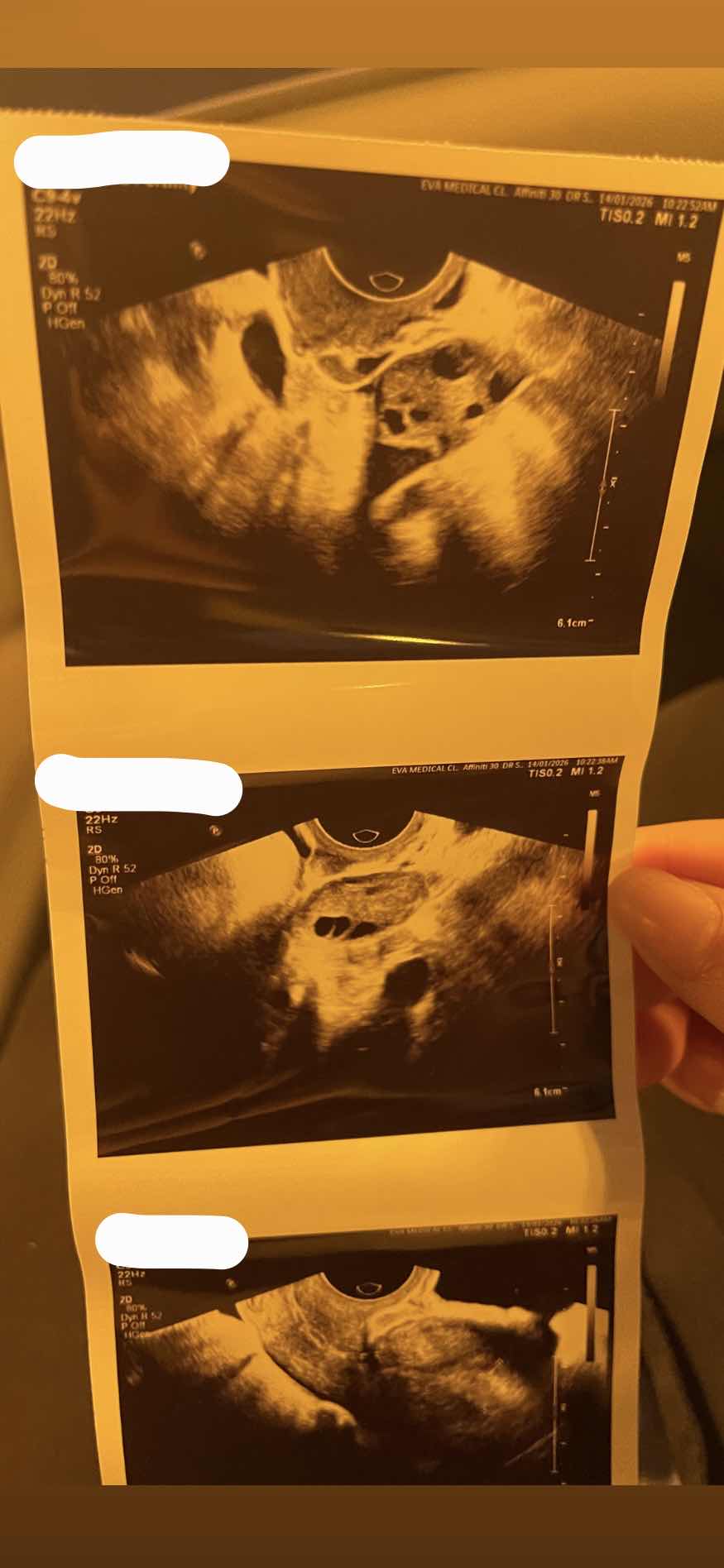 127A1F39-0EBA-4A33-8118-185DE7E696C2