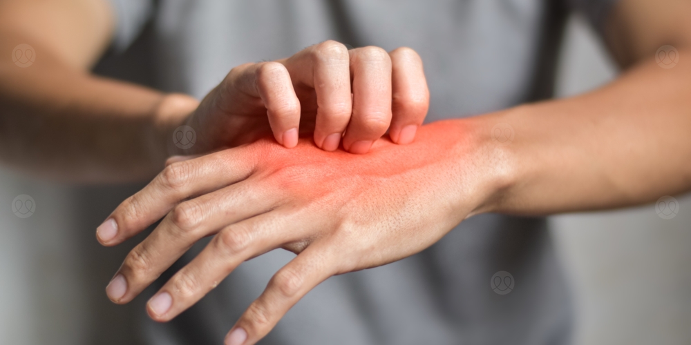 حبوب صغيرة في اليد مع حكة