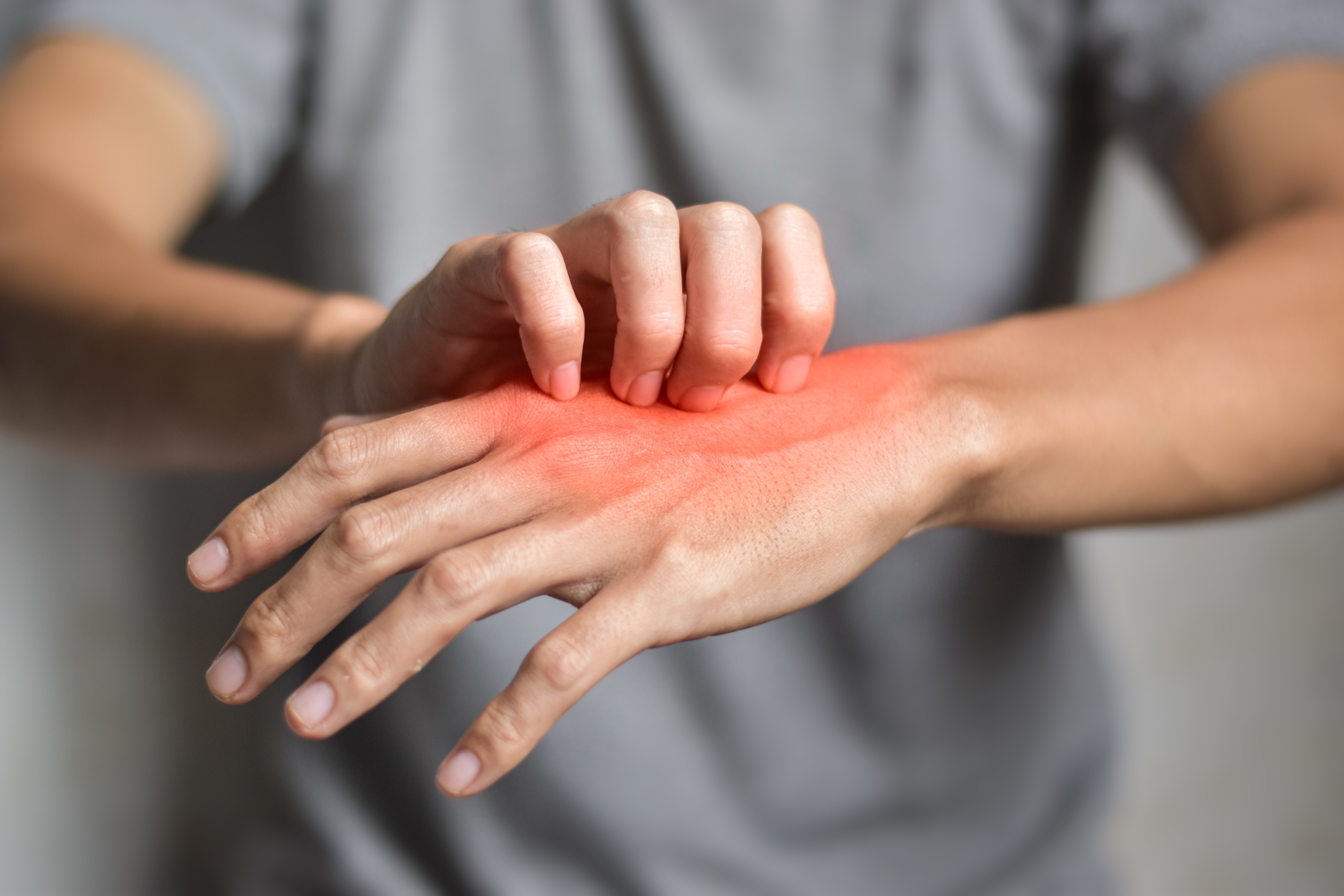 أنواع الطفح الجلدي بالصور: كيف تميز بينها؟