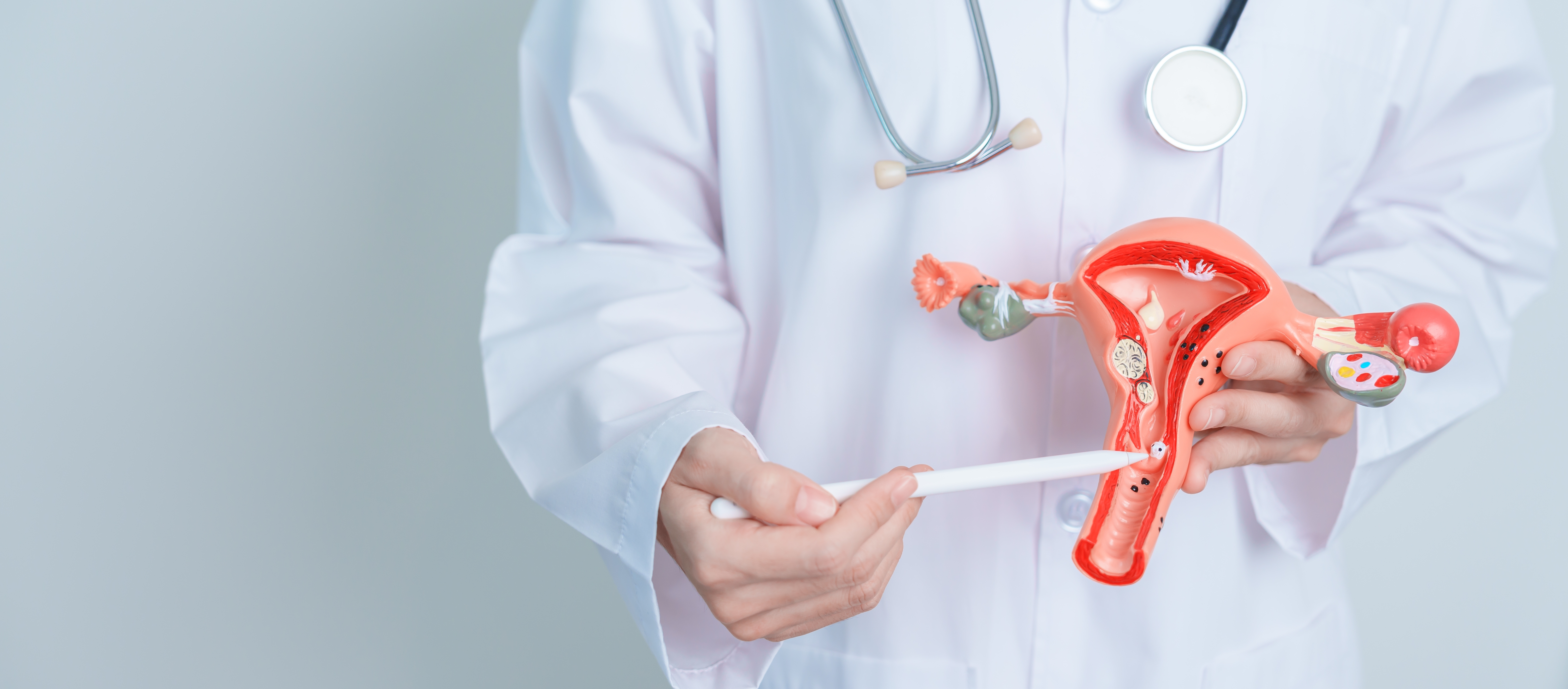 ما هي بطانة الرحم المهاجرة؟