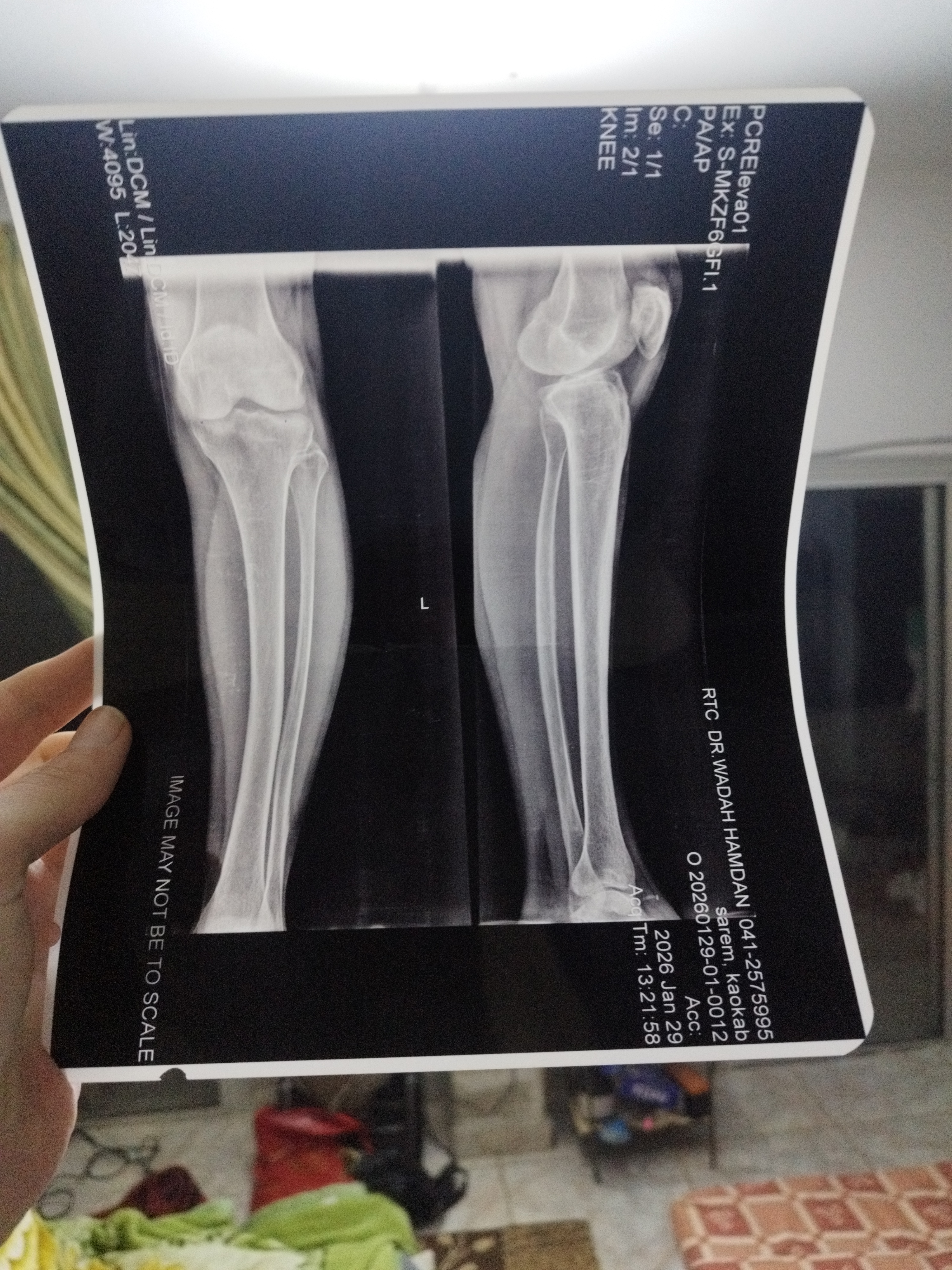 17704049955217348391910616170735