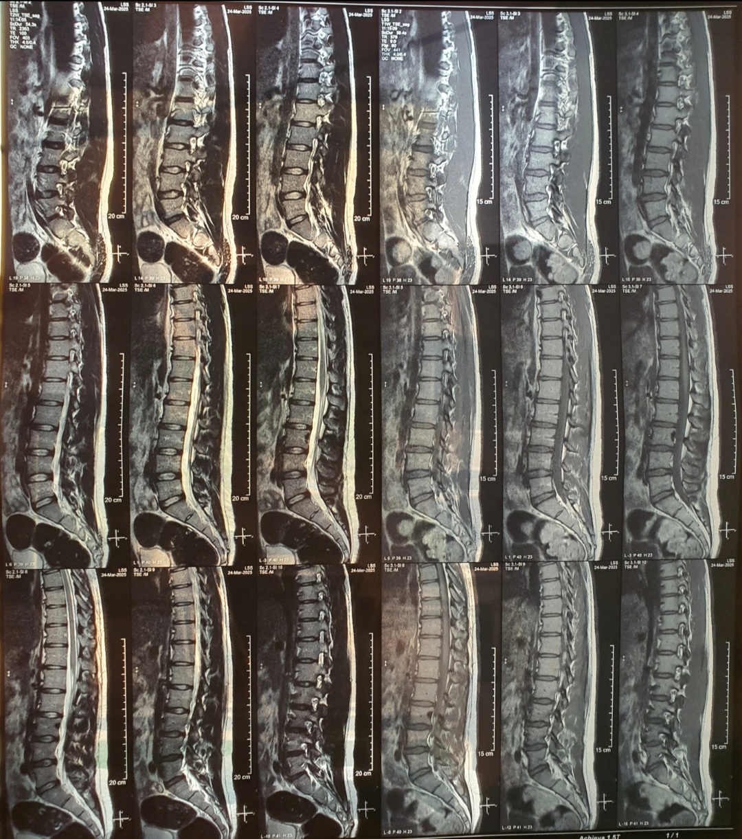 Screenshot_20260223-152610_Gallery