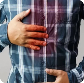  حموضة وحرقة المعدة في رمضان