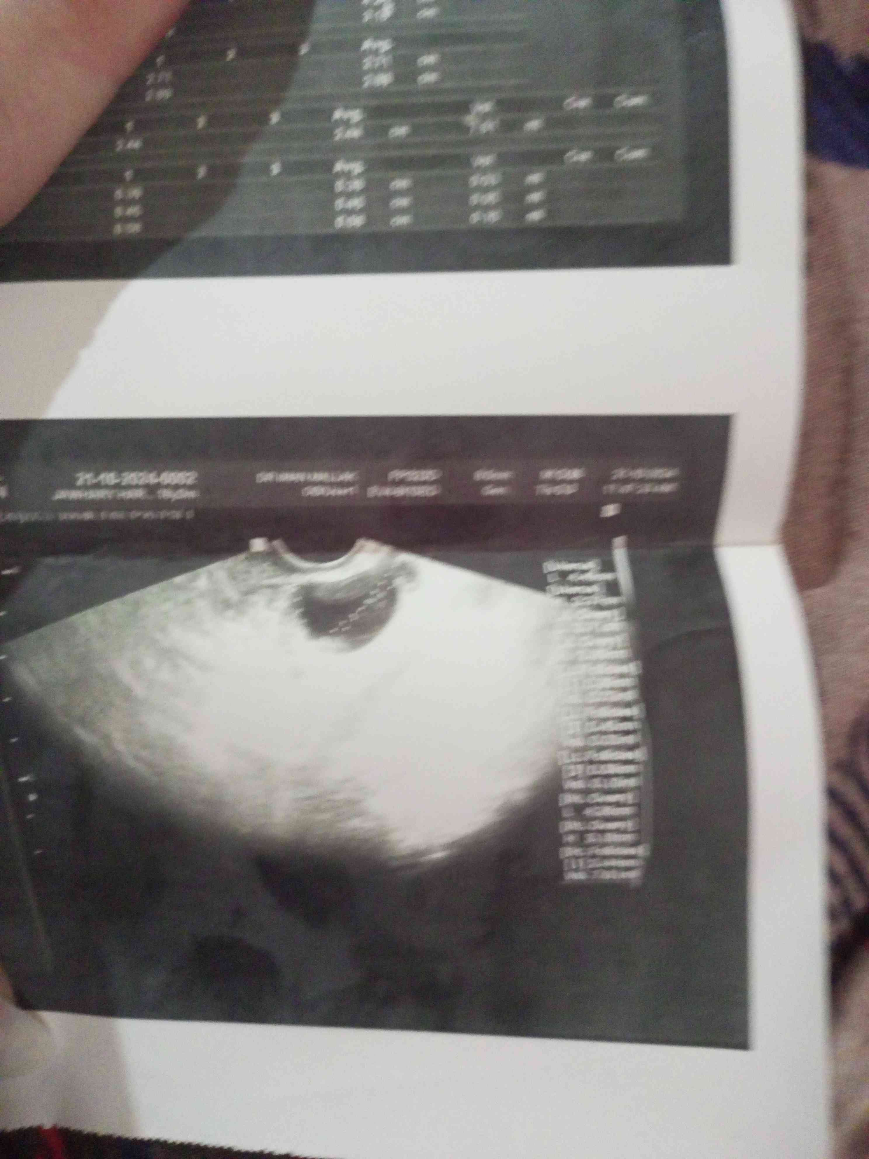 b63fd9c1-c05c-48e3-a2a2-f65f05e6af12