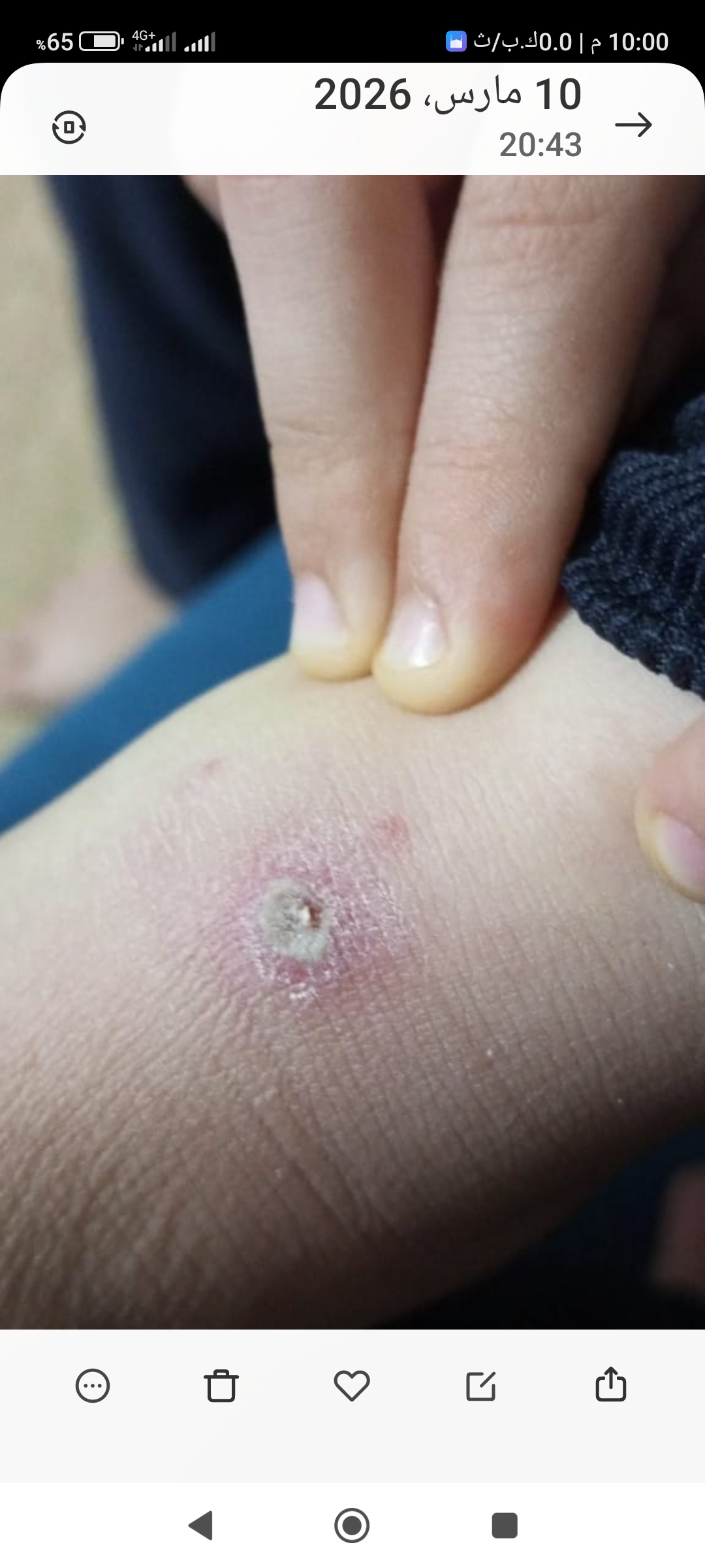 Screenshot_2026-03-10-22-00-25-473_com.miui.gallery