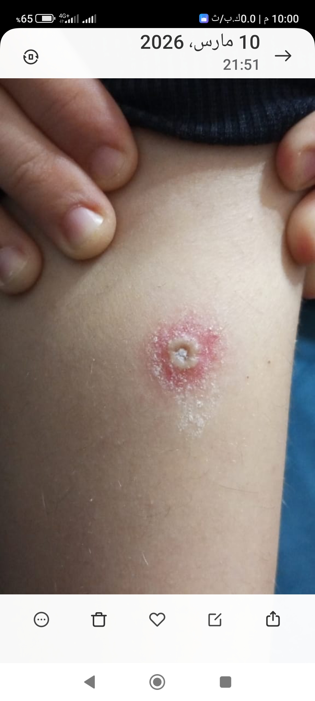 Screenshot_2026-03-10-22-00-21-494_com.miui.gallery