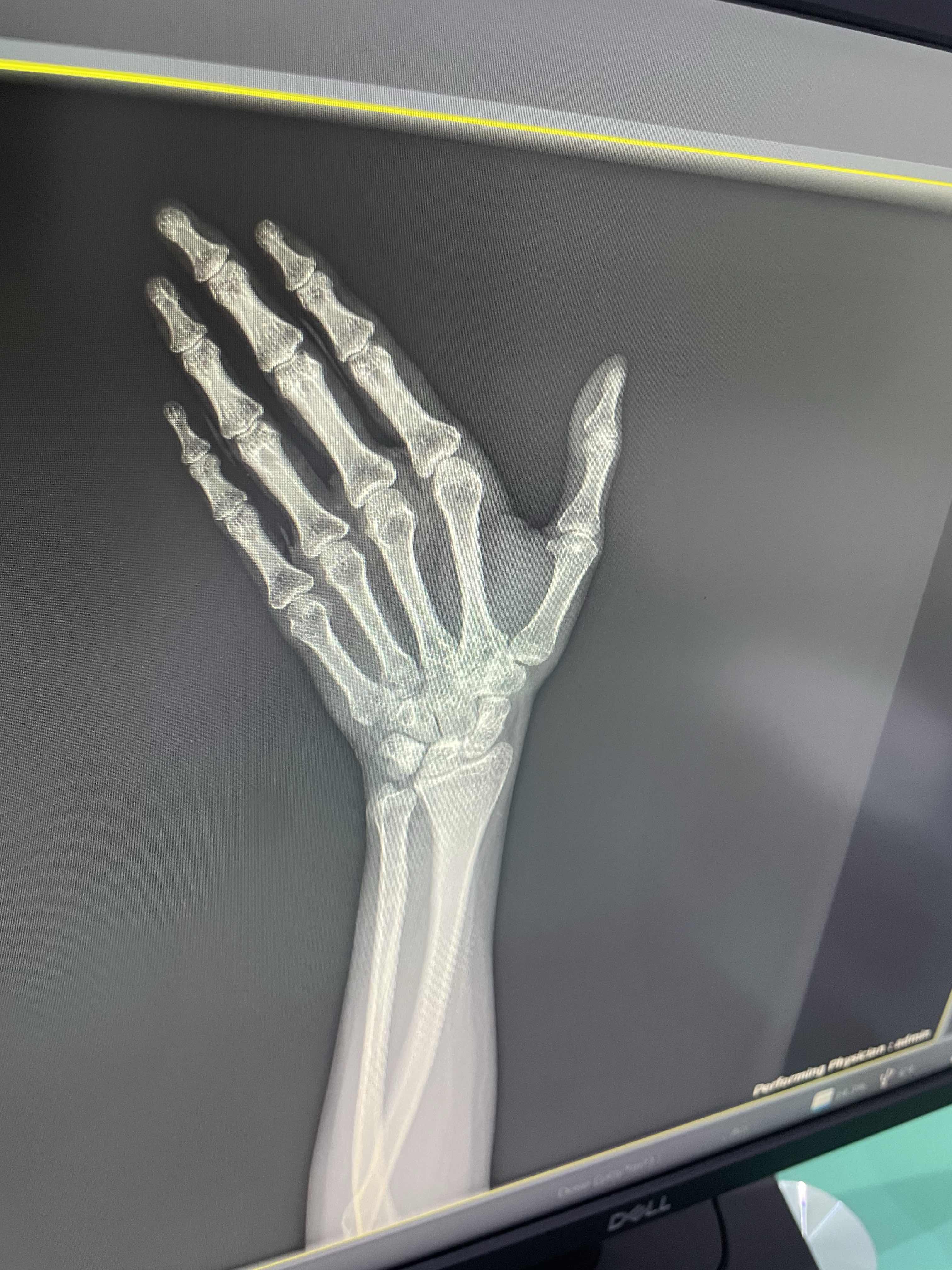 59A293E6-9AC9-4734-A4EB-8D4BCACCAFAD