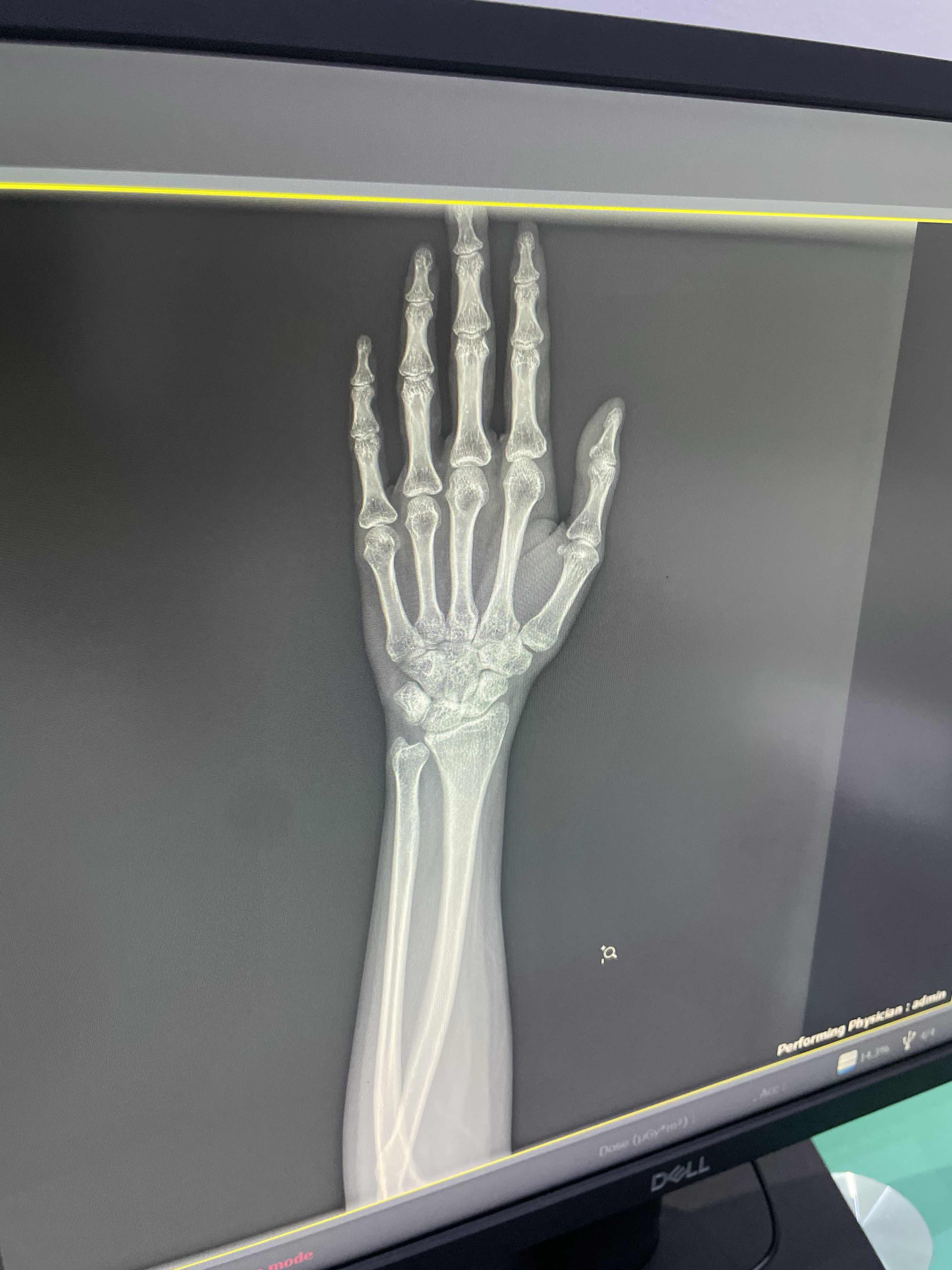 64D8DFB5-2074-4E3E-9845-880909FD4D39