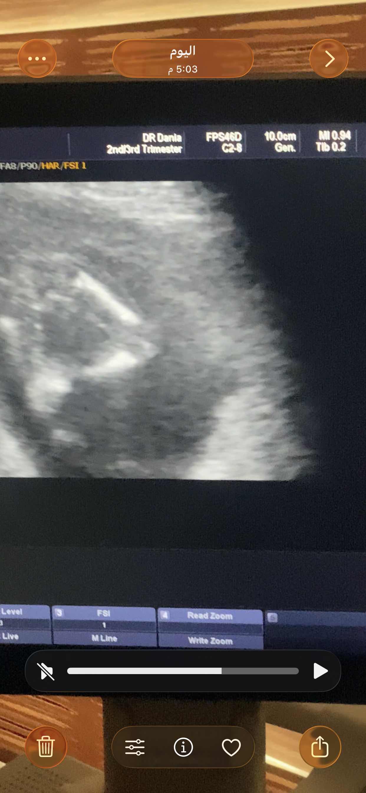 0518EC1B-D1DA-4314-8A93-009CFA2AA4D9