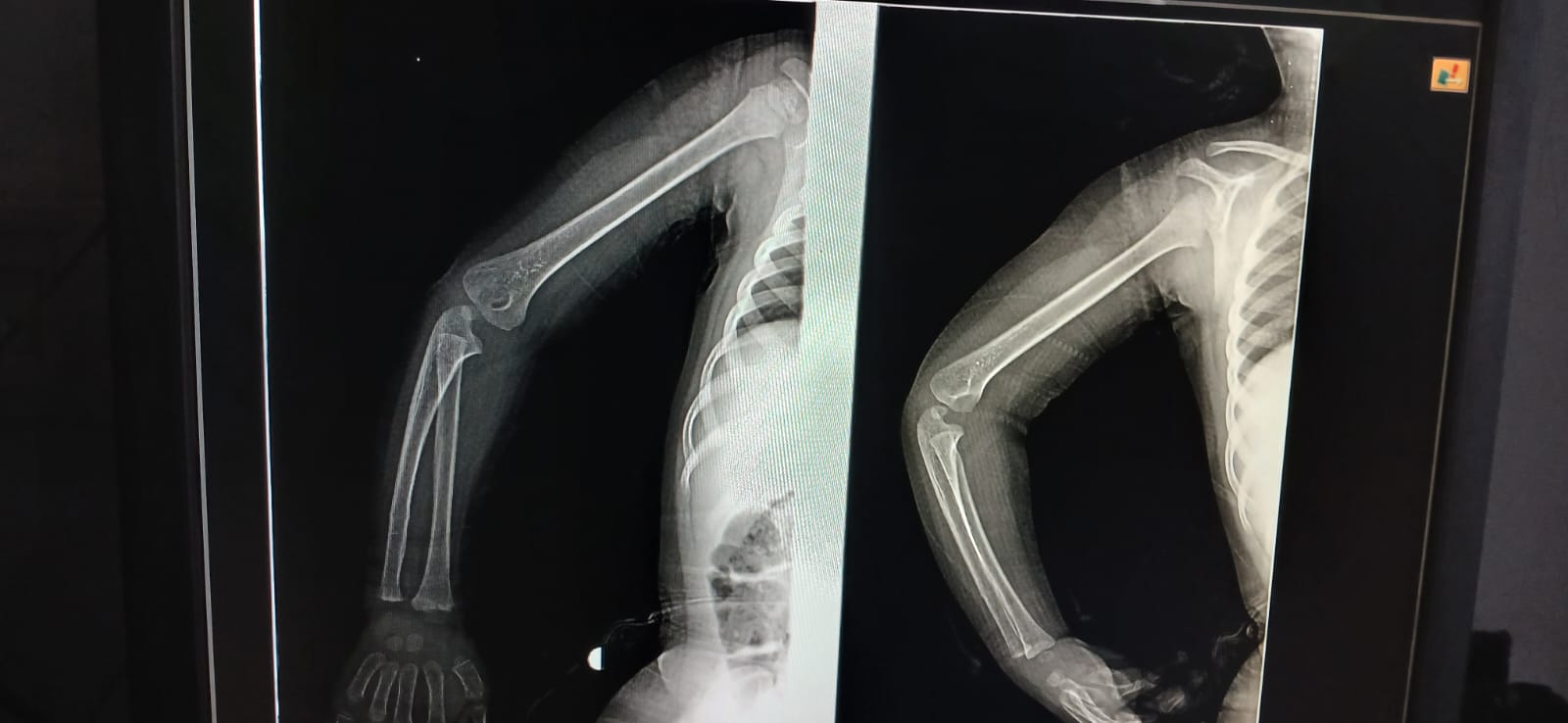 WhatsApp Image 2026-03-16 at 9.17.26 AM _2_