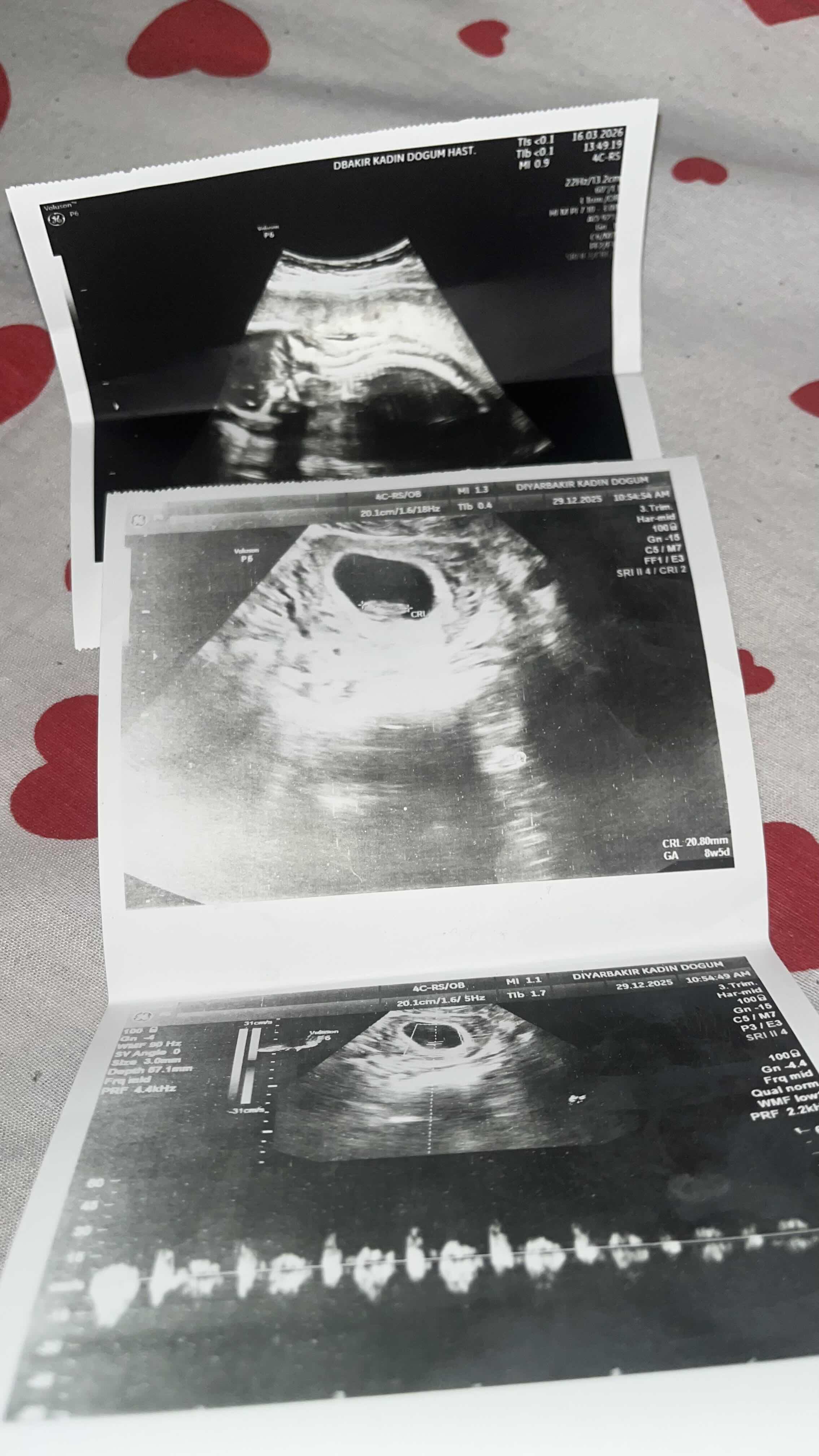 899B399C-7AA0-4EFA-9033-586CF96AFD16