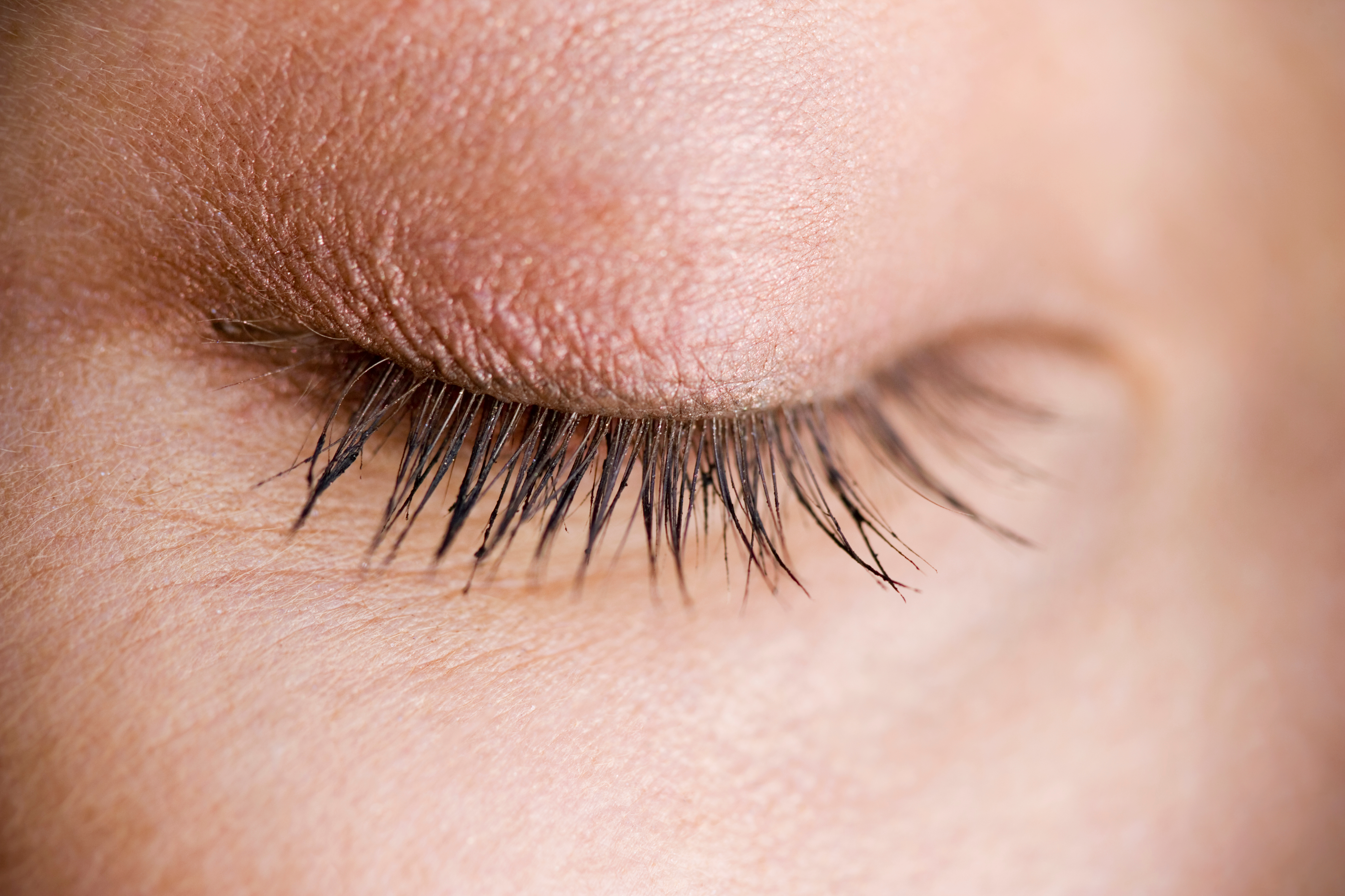 تعرف على أمراض جفن العين بالصور