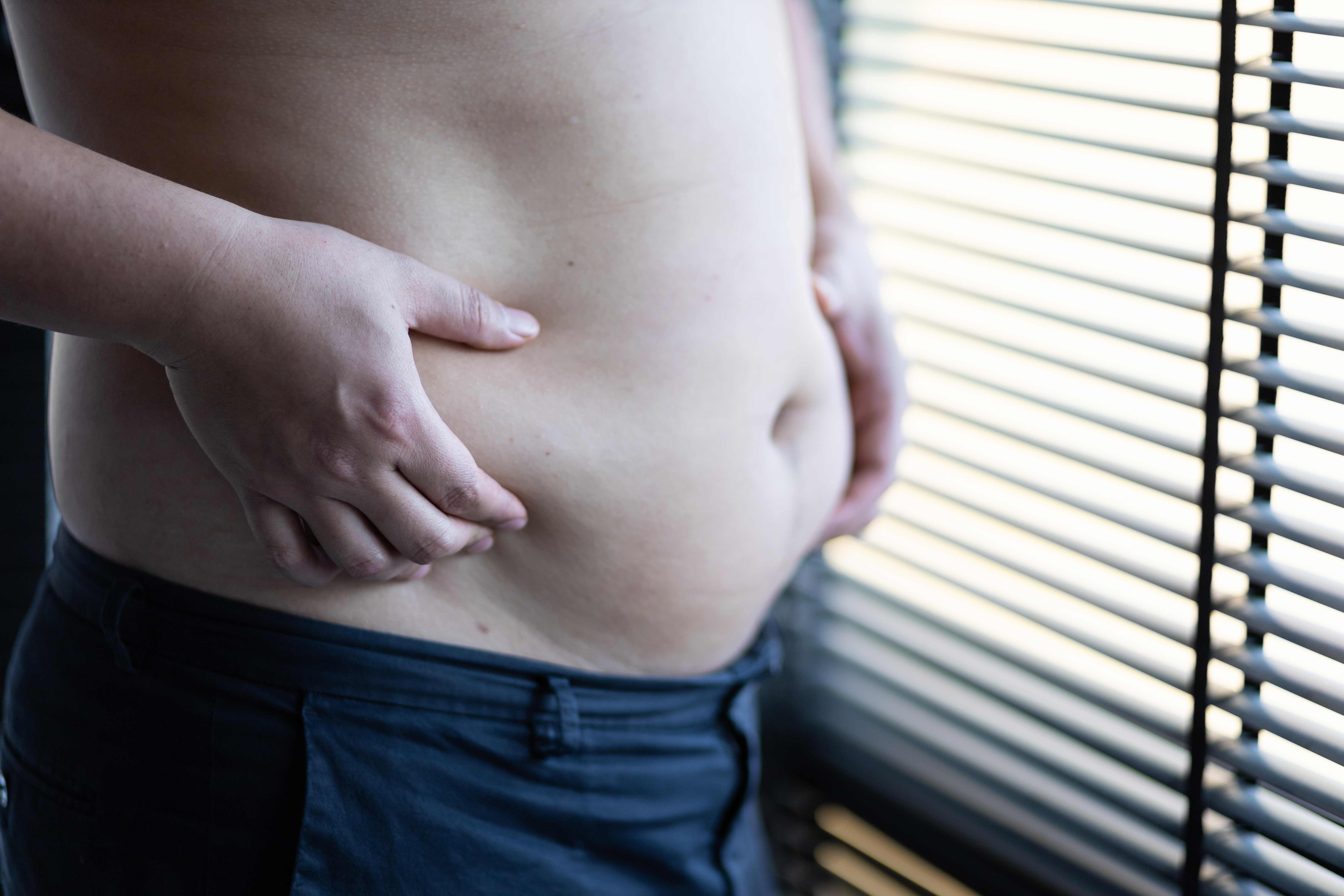 كيف يبدو شكل بطن مريض الكبد؟