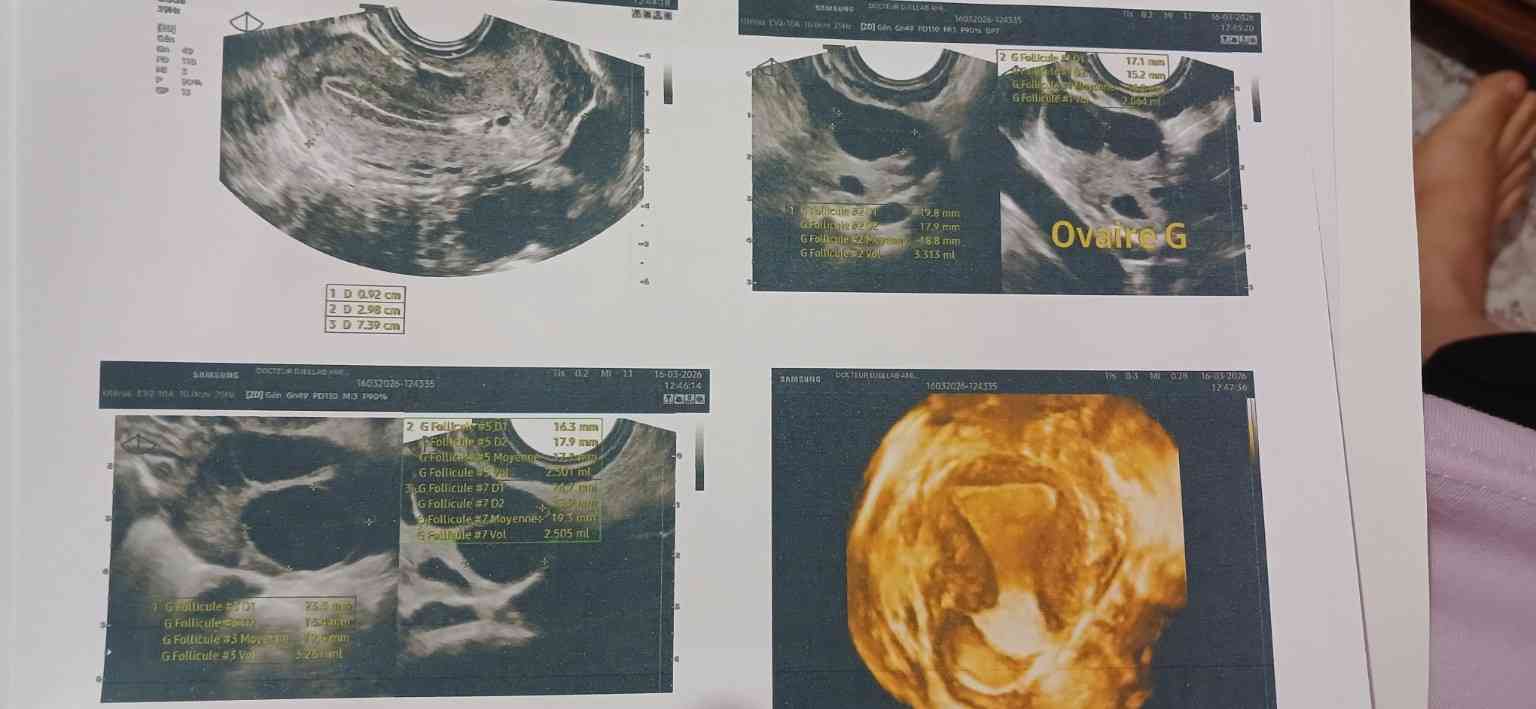 ebe158e4-808f-4da2-9c8c-7bfe6c886329