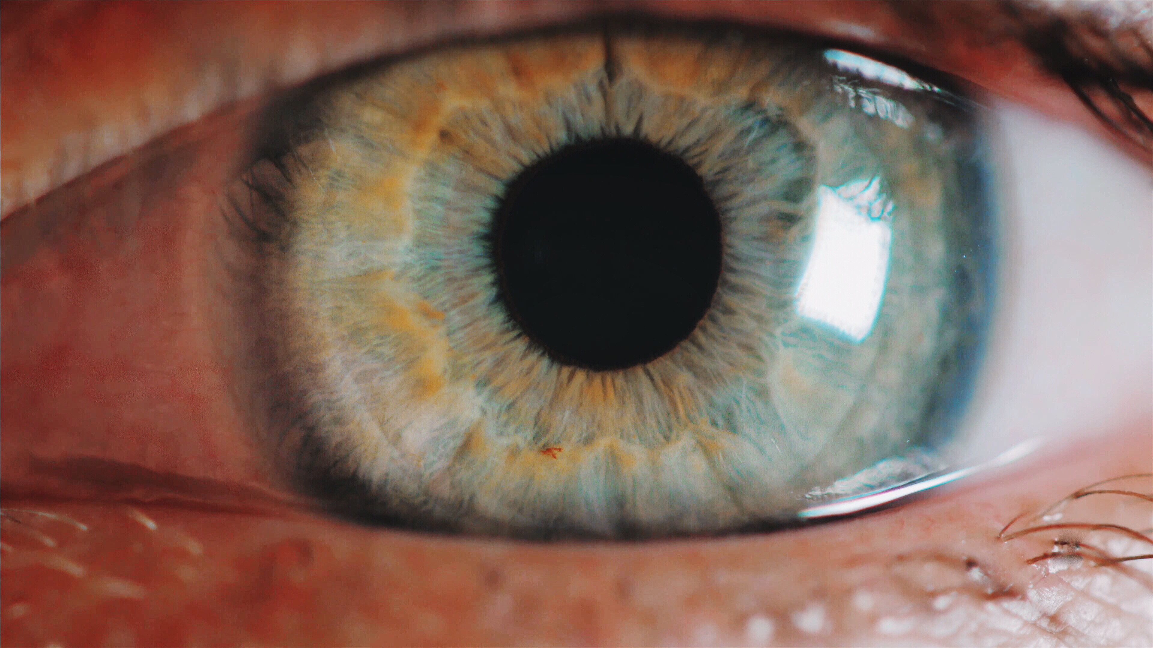 ملتحمة العين: ما هي ووظائفها وأهم المشكلات بالصور