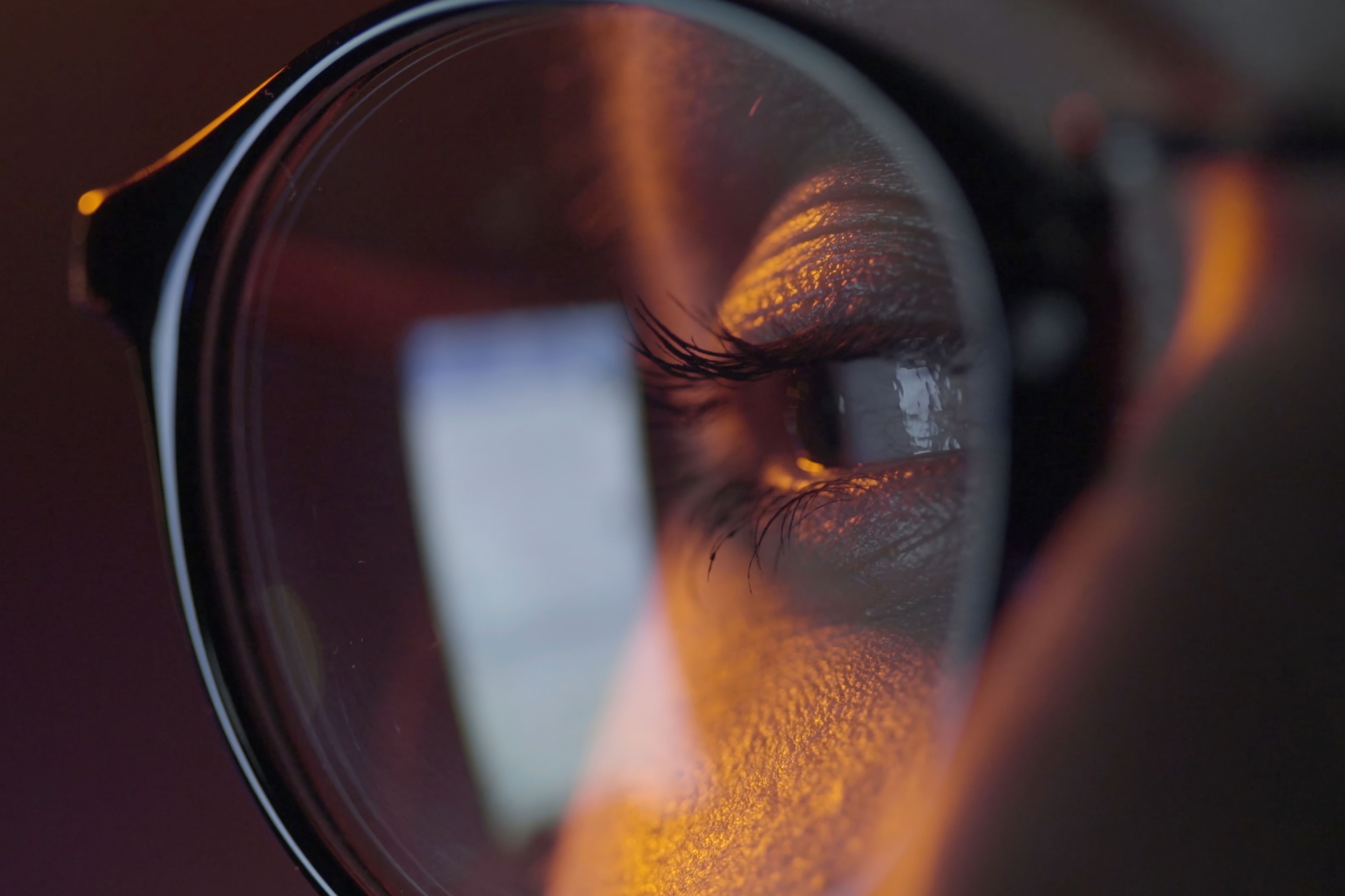 7. أخطاء الانكسار (Refractive errors)