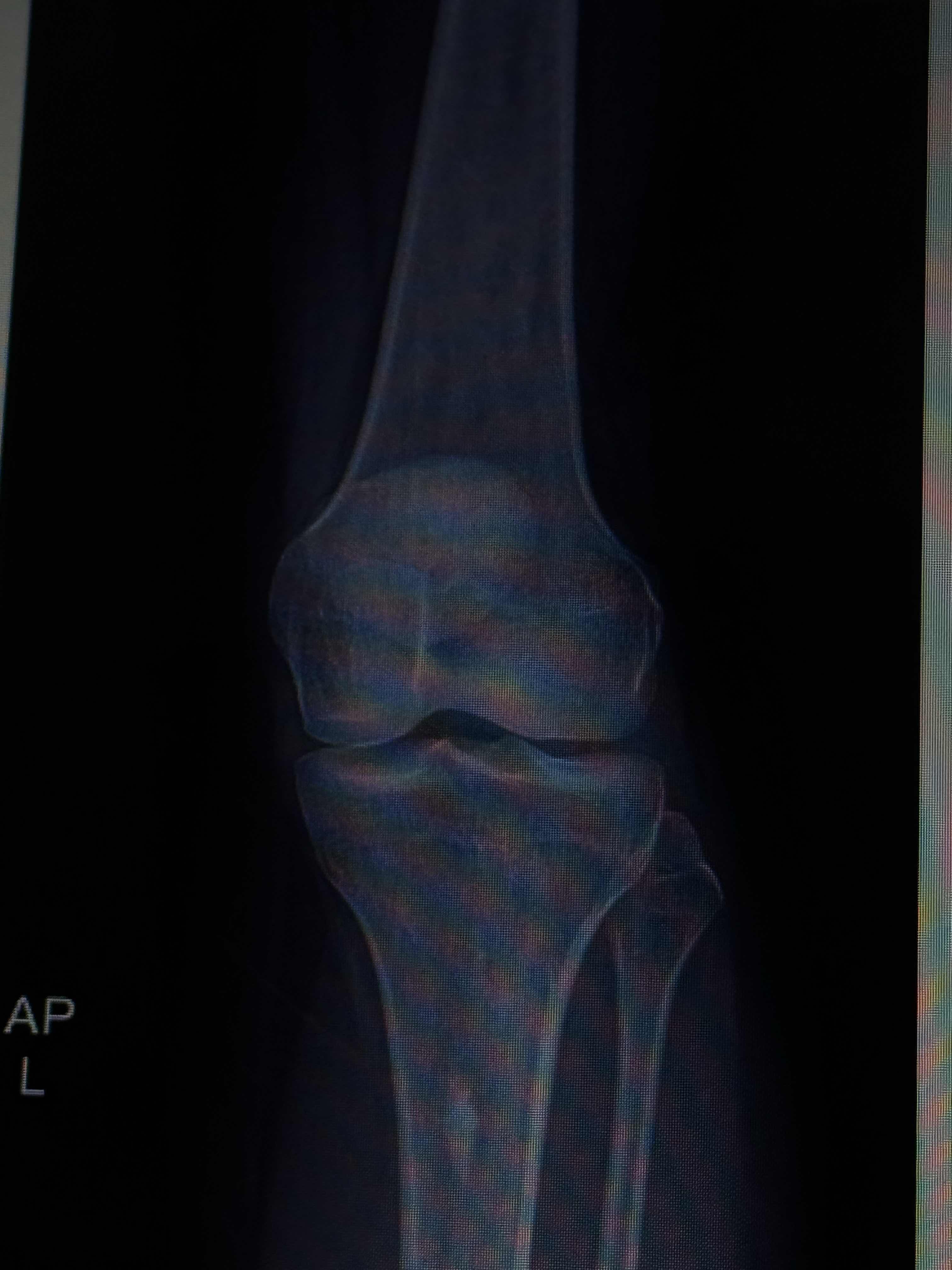 B0A53CFA-4E52-455E-BE74-34B416818F1B