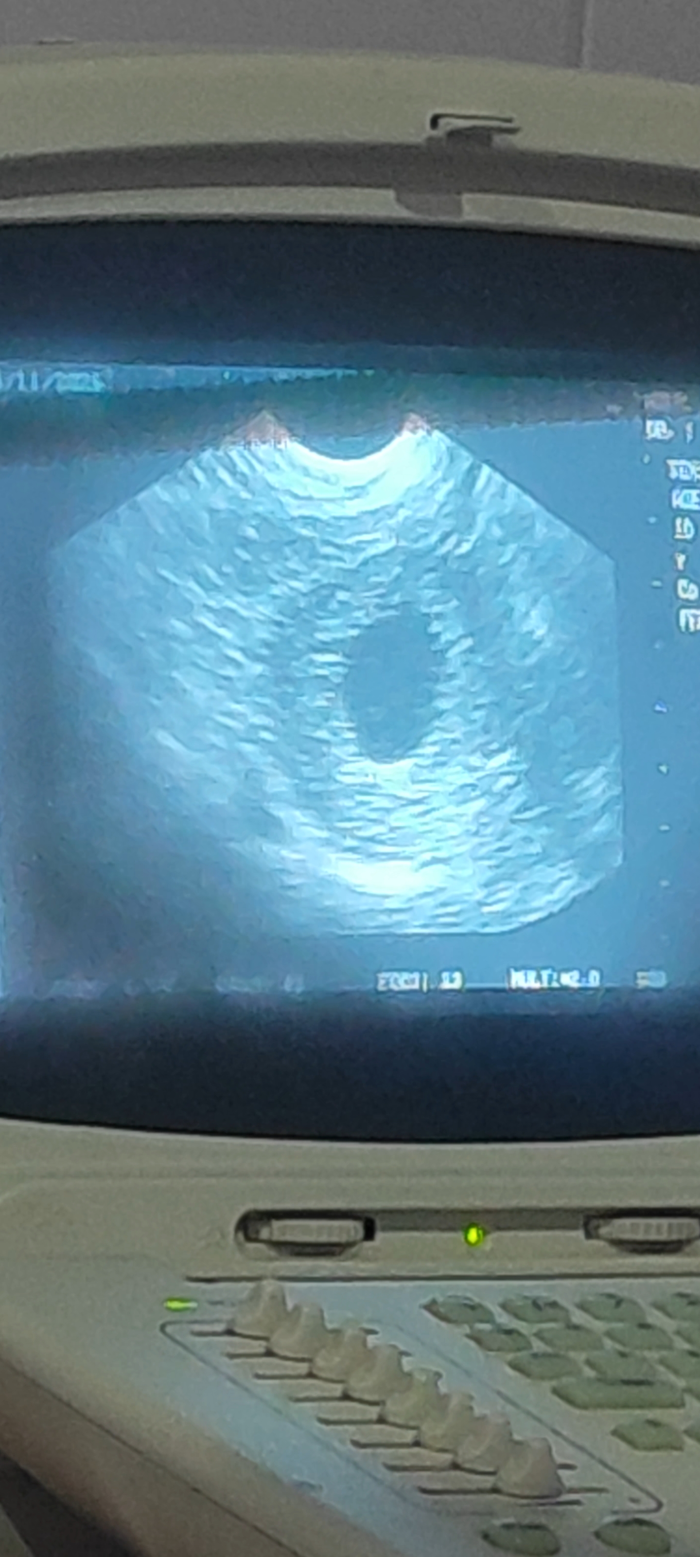 Screenshot_2026-04-11-18-28-44-329_com.miui.videoplayer