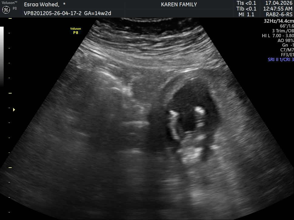 2C926F15-6423-4BB4-8254-0B0251175E31