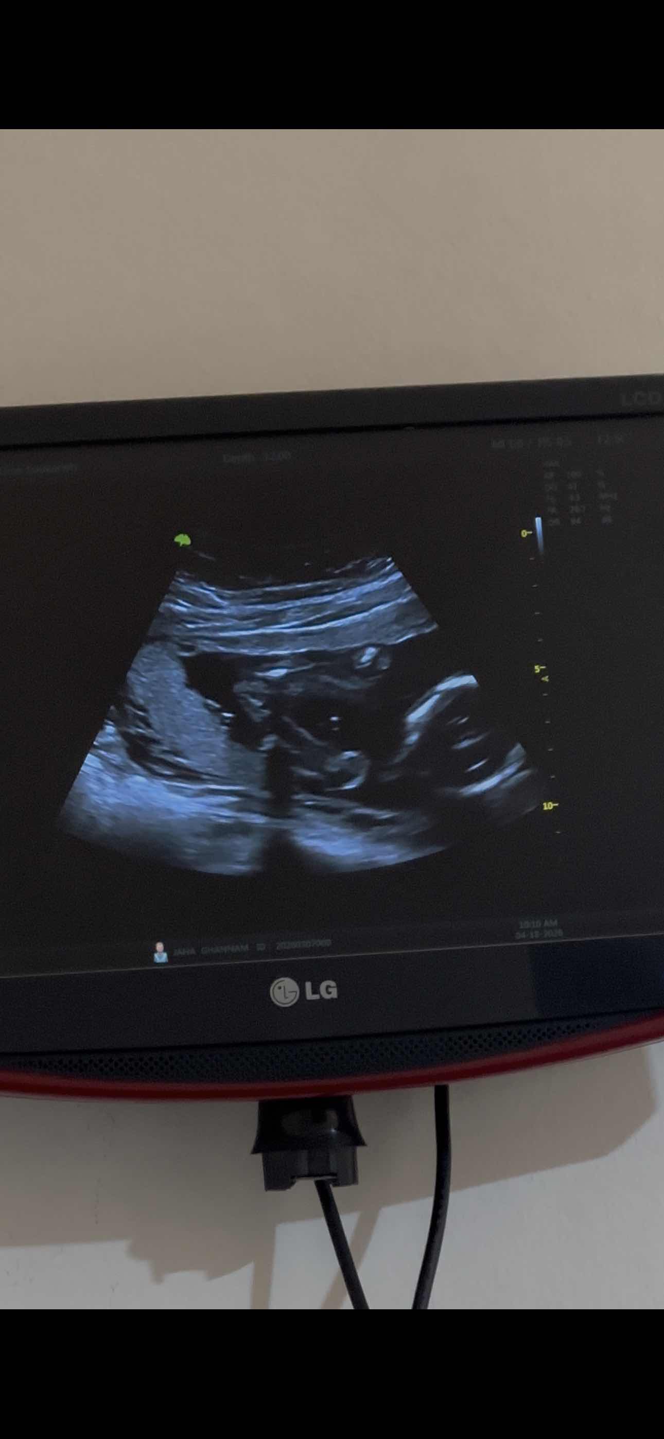 137A98EE-E539-4A52-9F57-AF2F0F4EE376