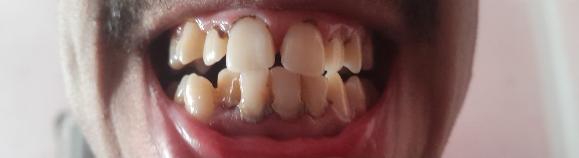 1000027553