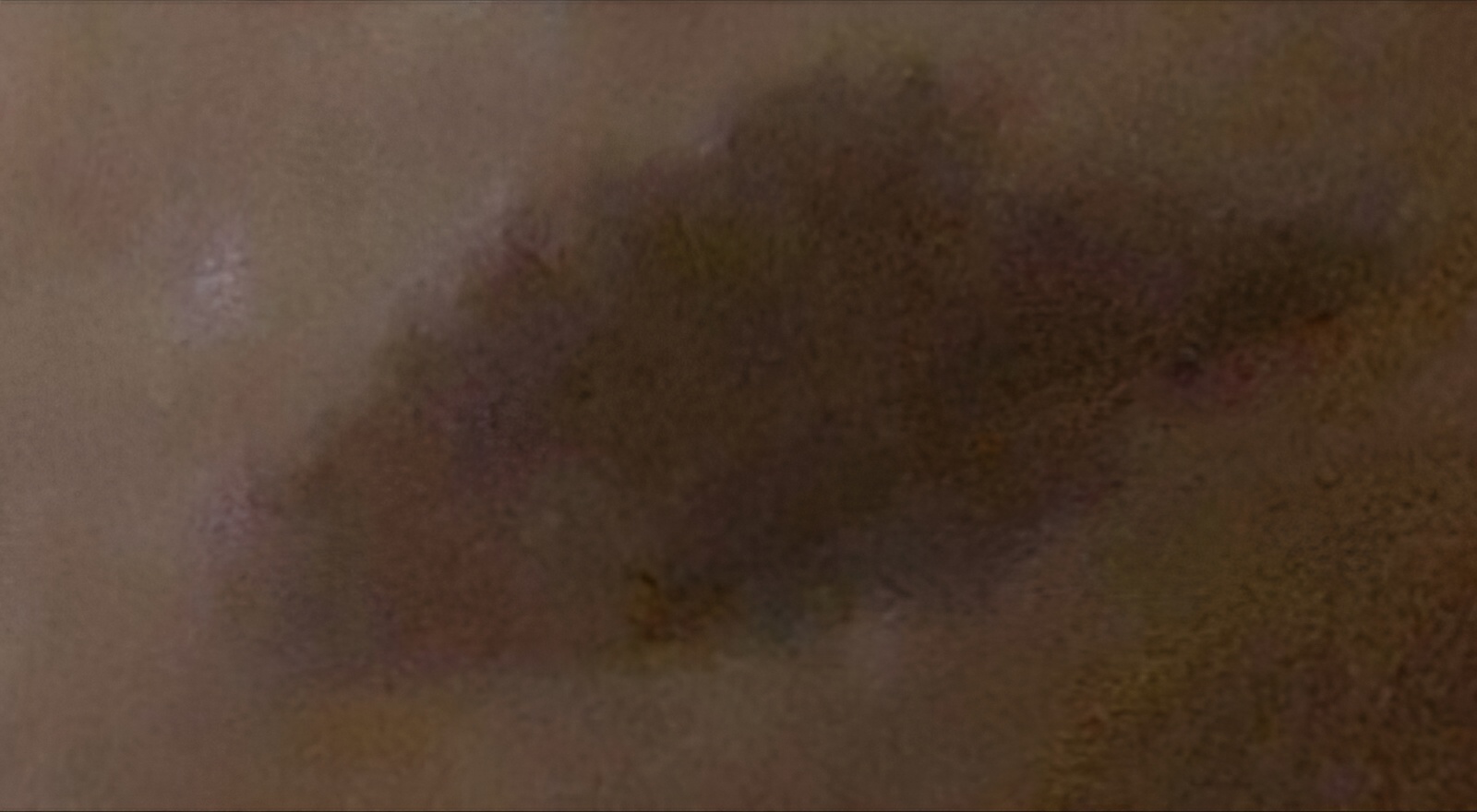1000246665