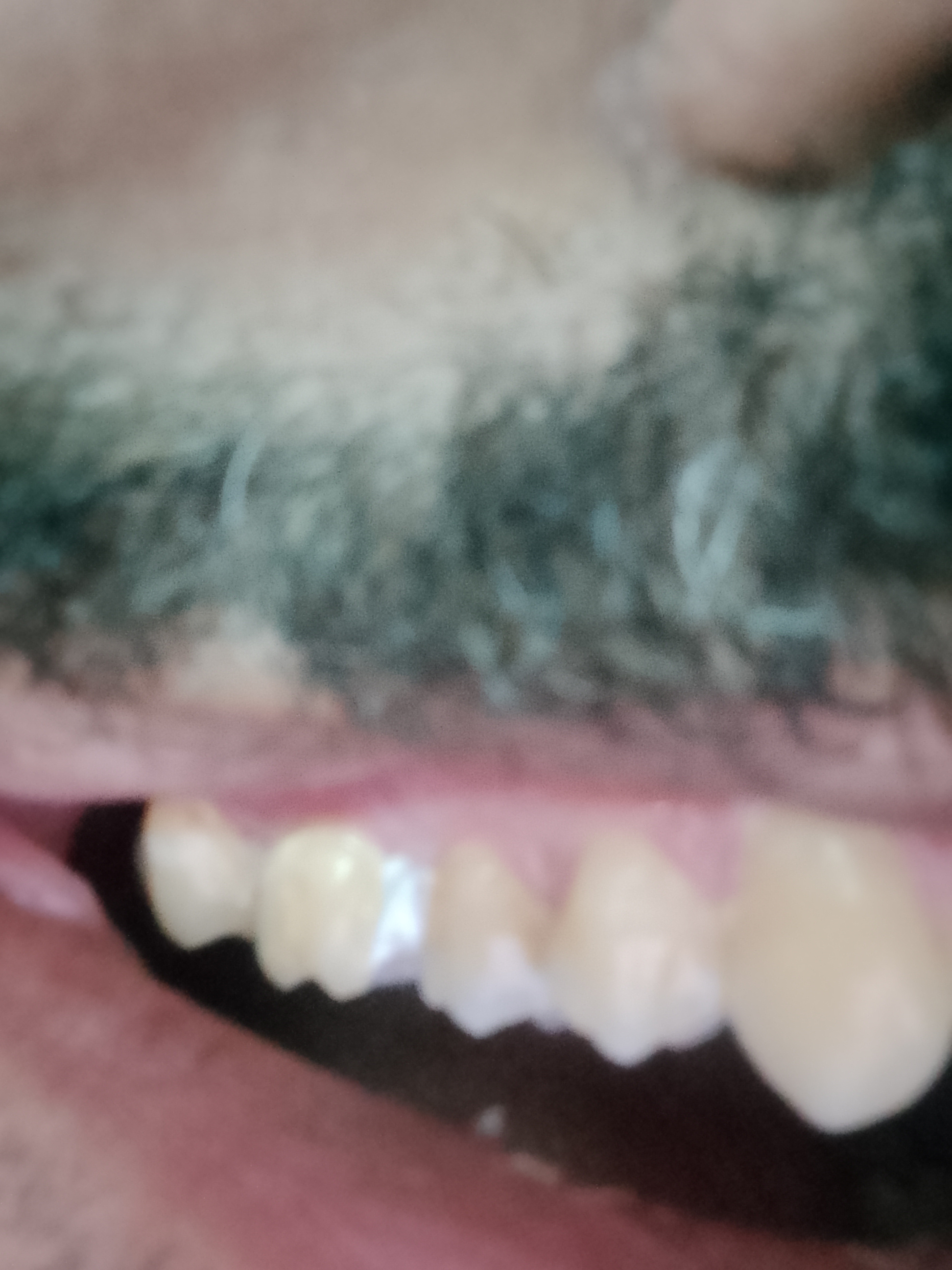 1000052151