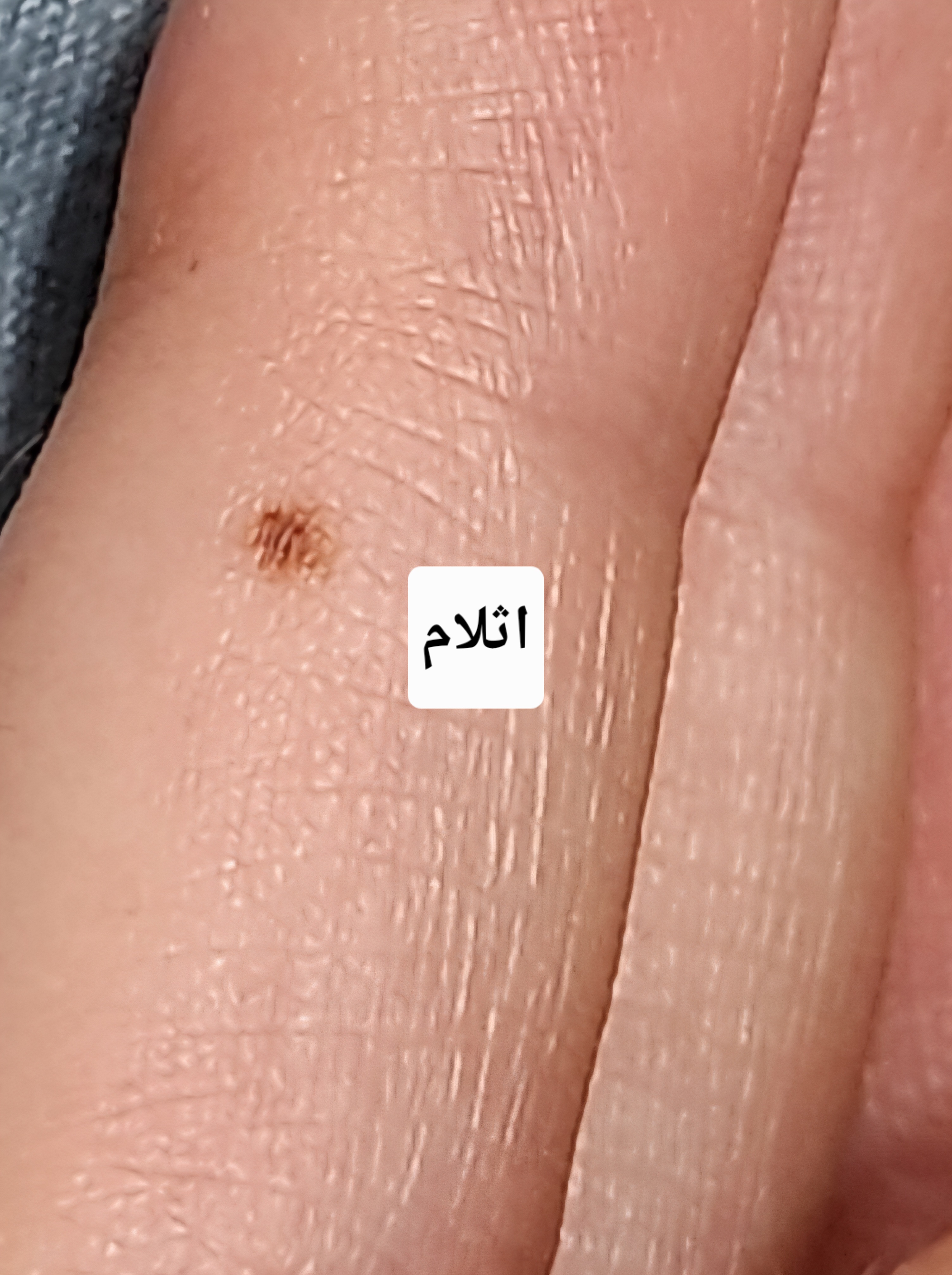 Screenshot_٢٠٢٦٠٧٢٧_٢١١٩٠٢_Gallery