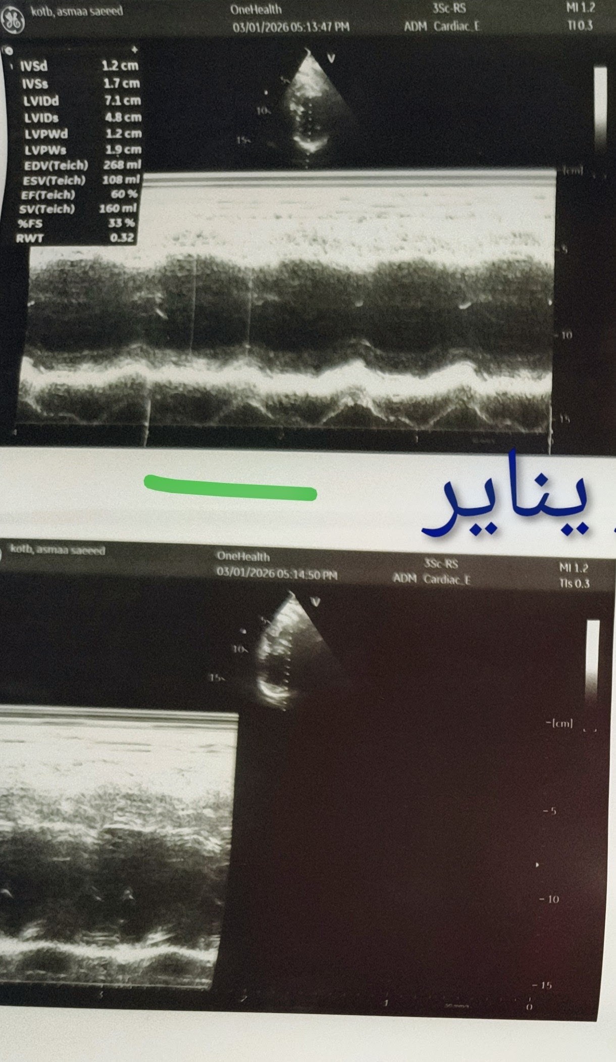 1000107420