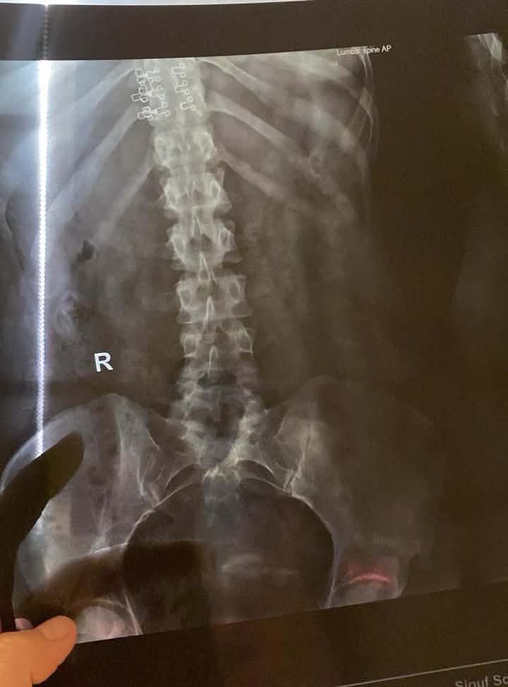 pic 1