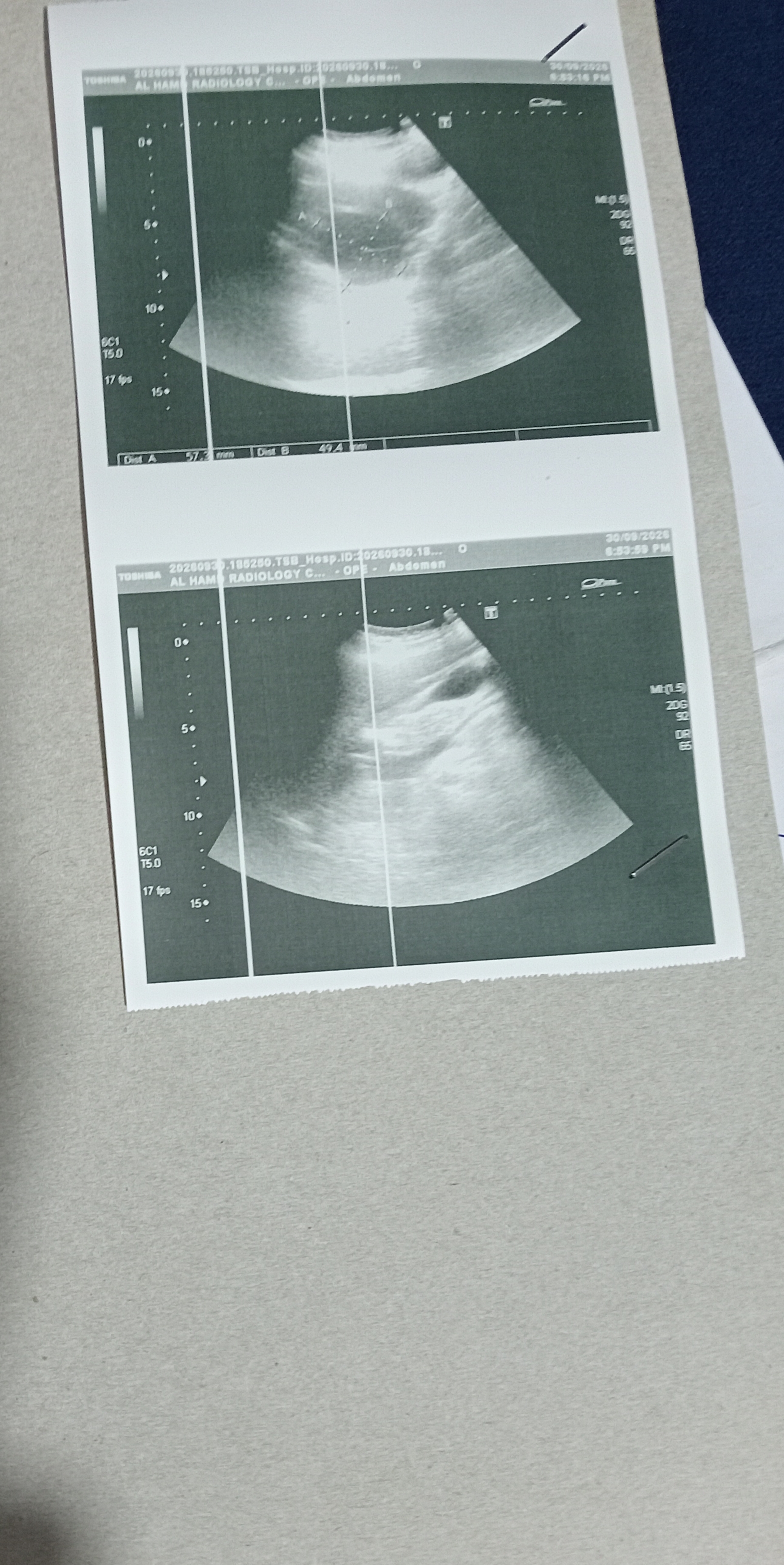 IMG_٢٠٢٦٠٩٣٠_٢٢٢٥٥٧