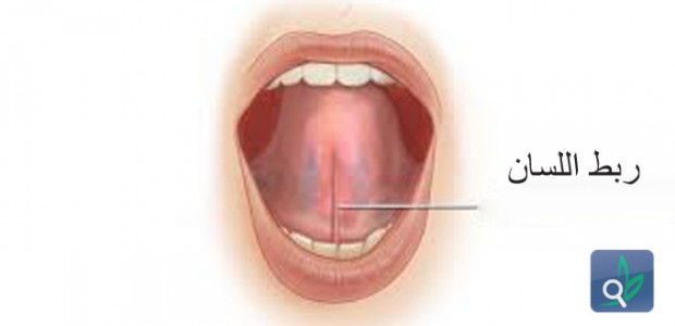ظهور حبه حمرا تحت اللسان ما السبب الطبي