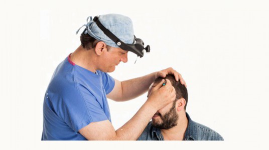 التقنيات المستخدمة في زراعة الشعر خلال عام 2016