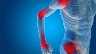 ألم العضلات الروماتزمي (Polymyalgia Rheumatica PMR)